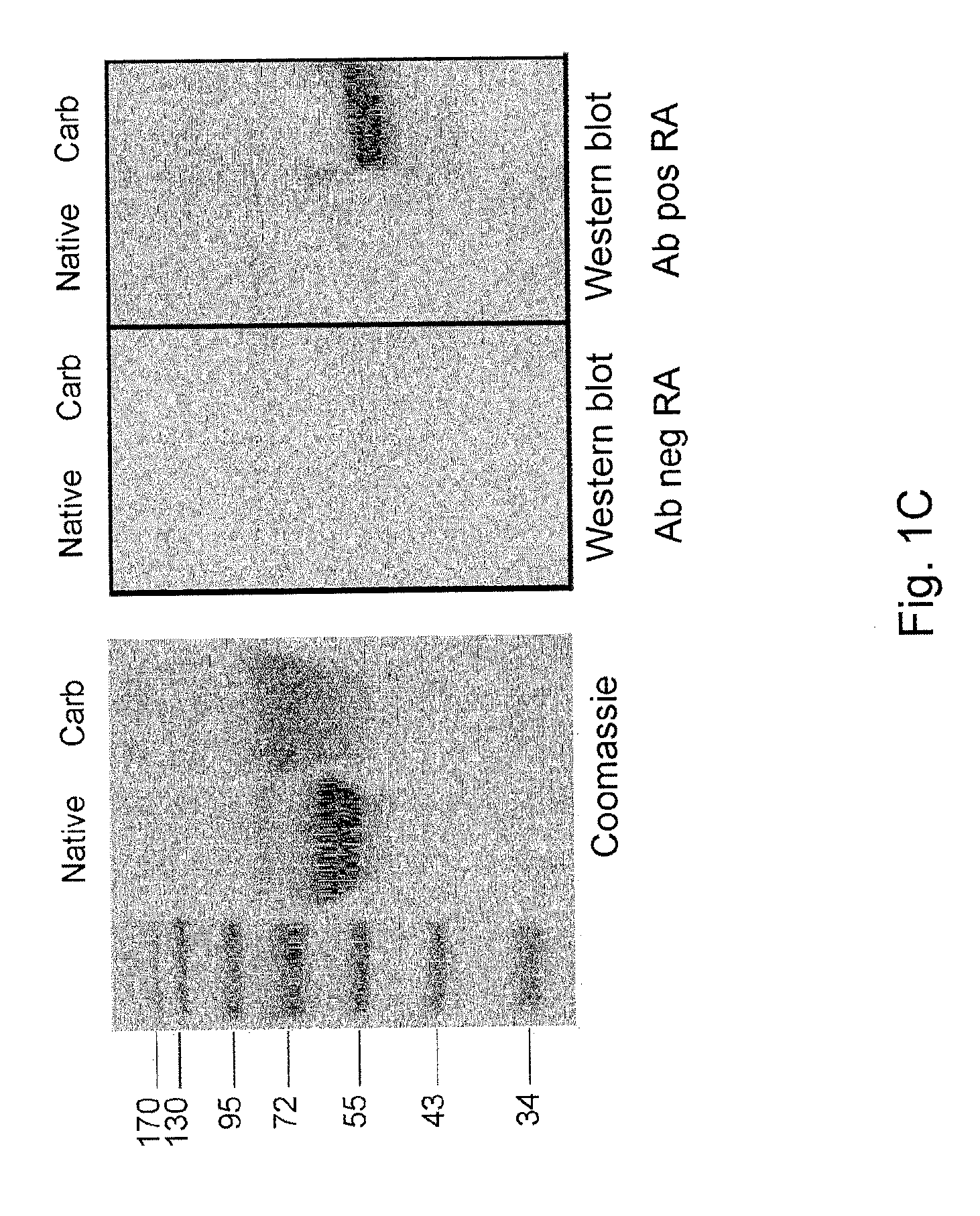 Anti-carbamylated protein antibodies and the risk for arthritis