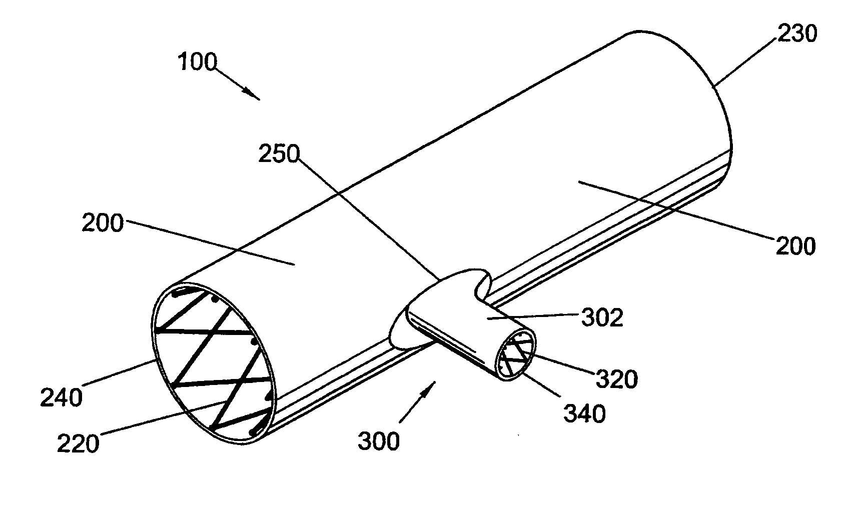 Bifurcated side-access intravascular stent graft