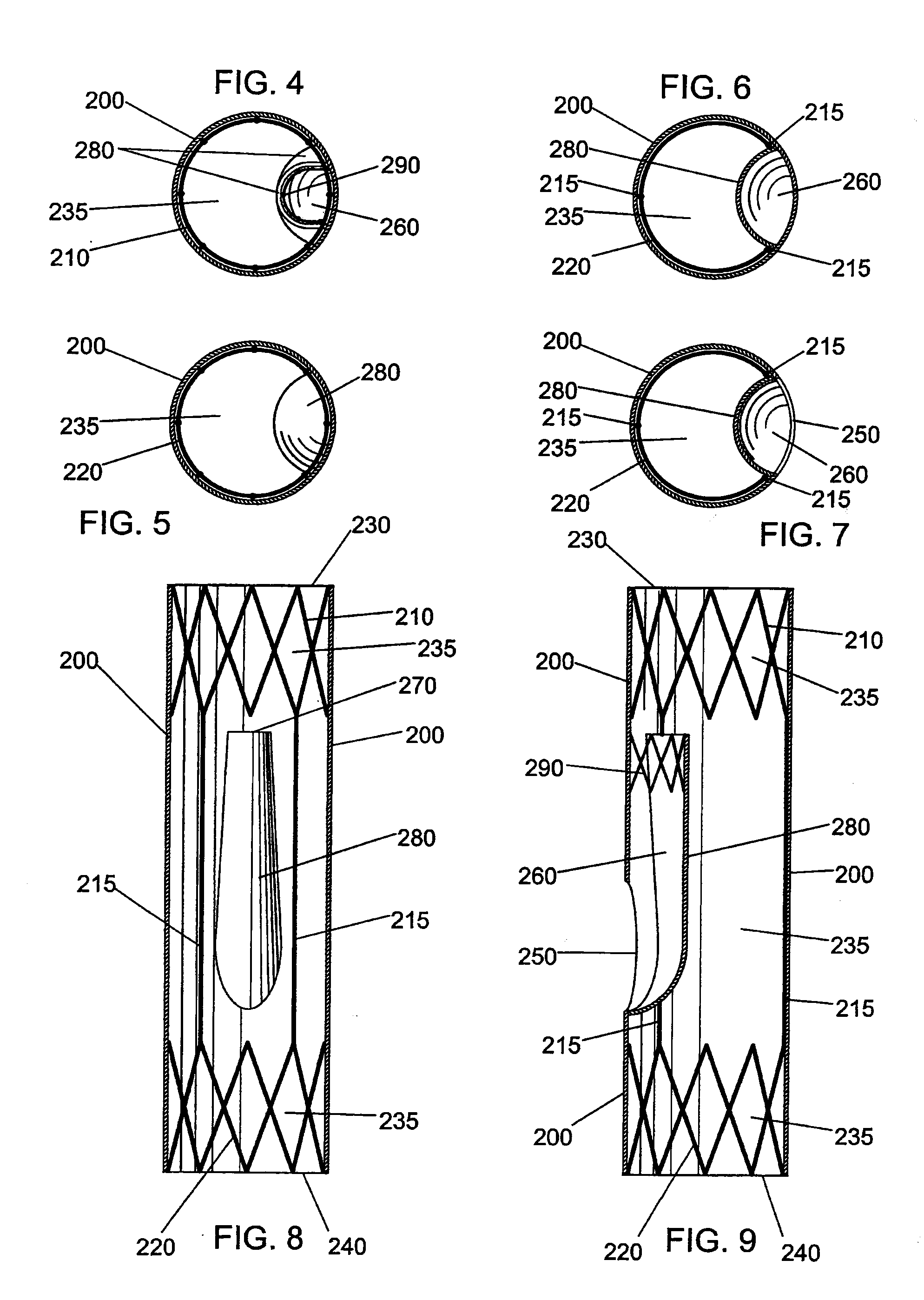 Bifurcated side-access intravascular stent graft