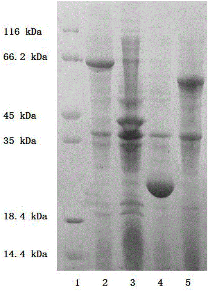 Method for regenerating ATP (adenosine triphosphate) by enzyme process and application thereof