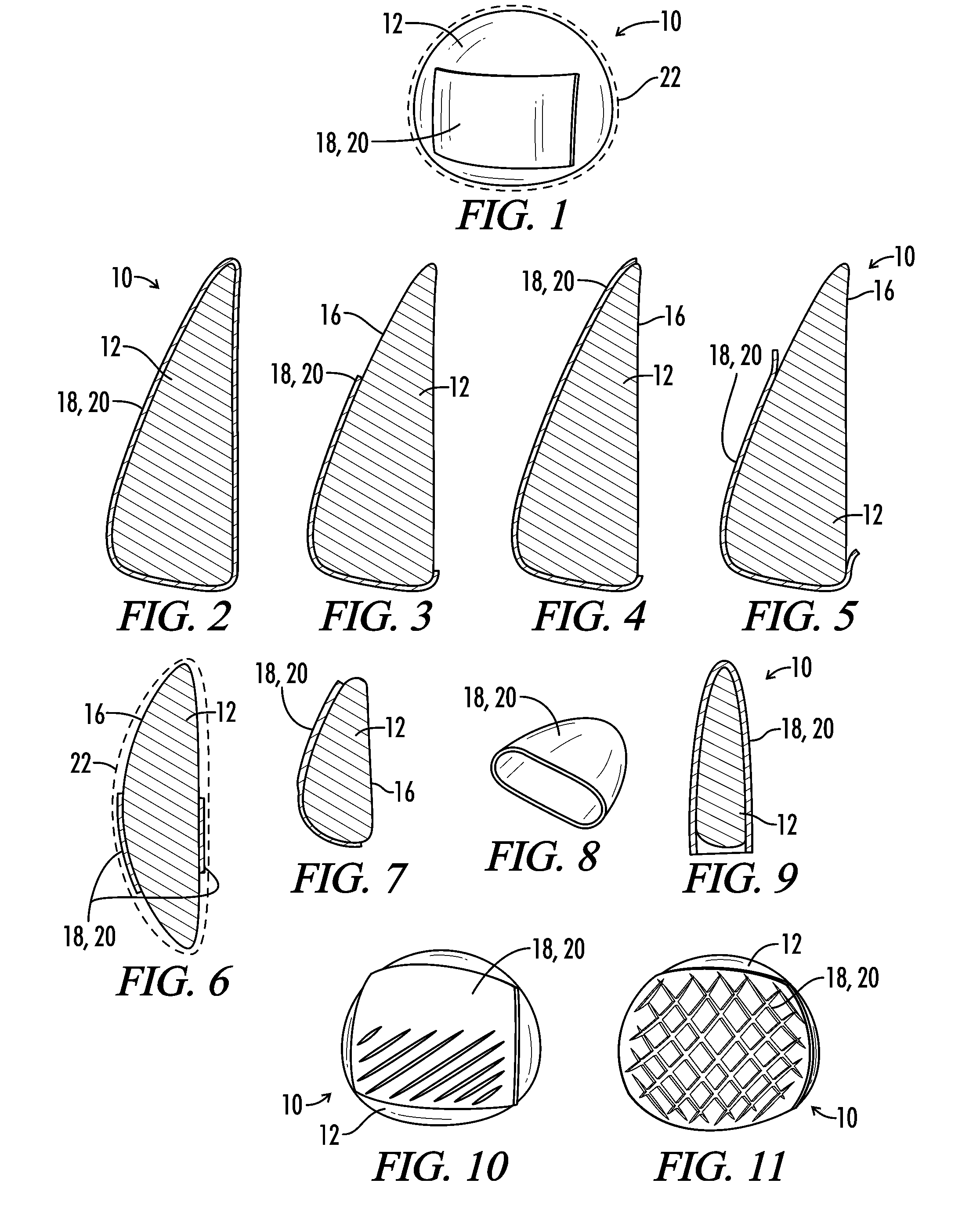 Interfaced medical implant