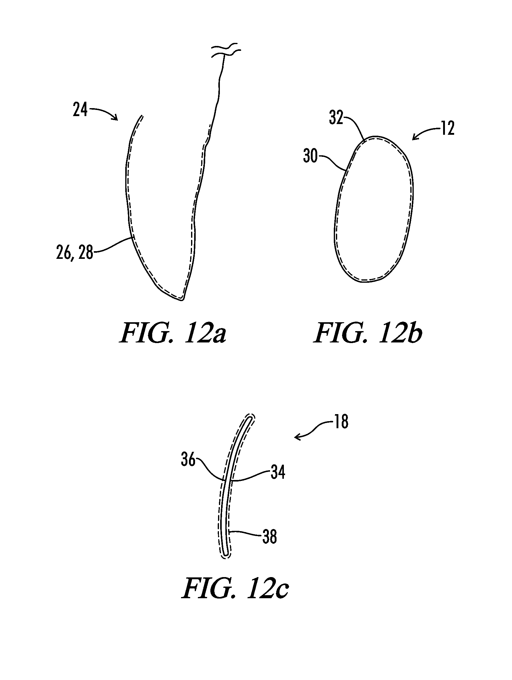 Interfaced medical implant