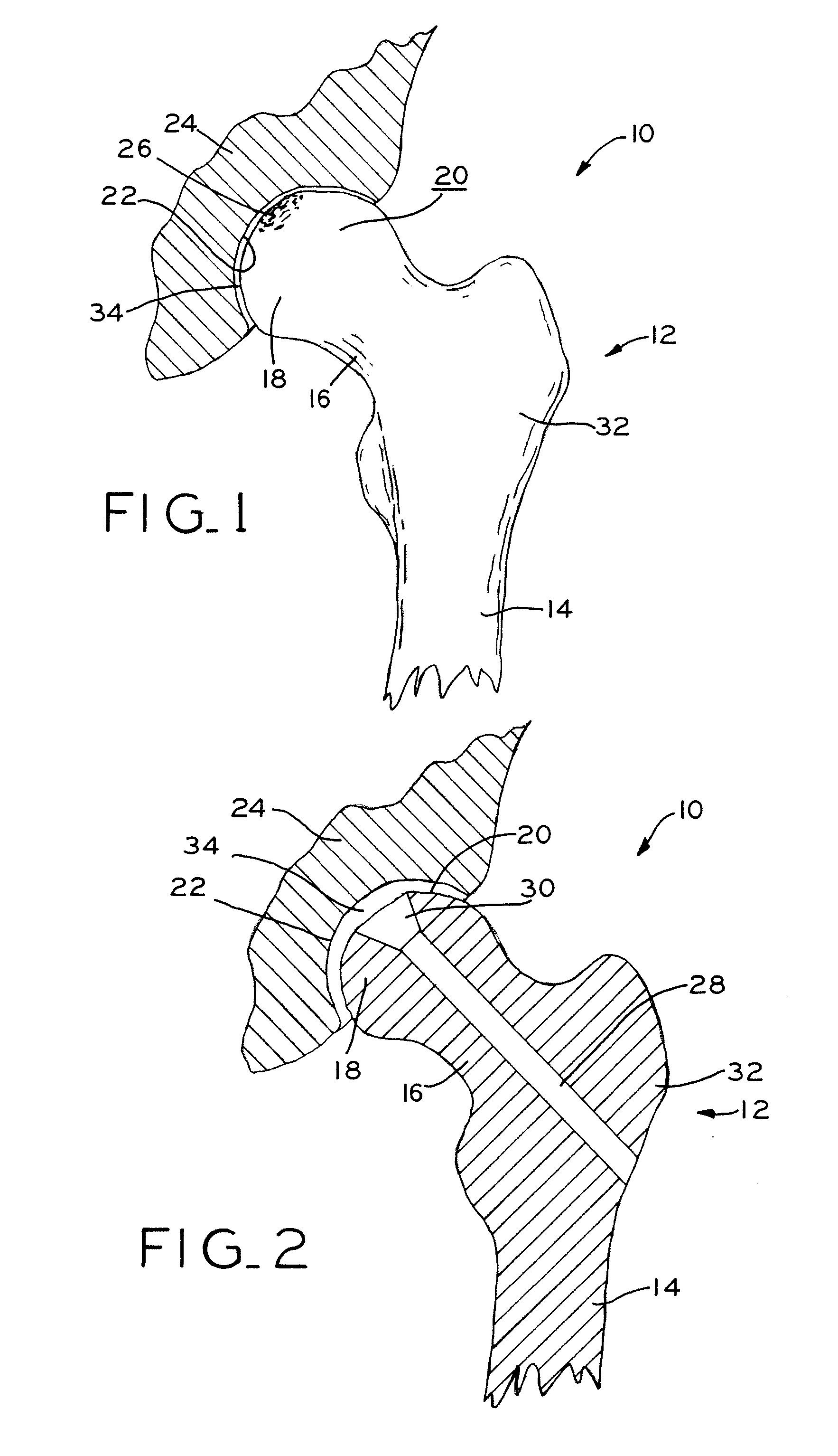 Methods for repairing defects in bone