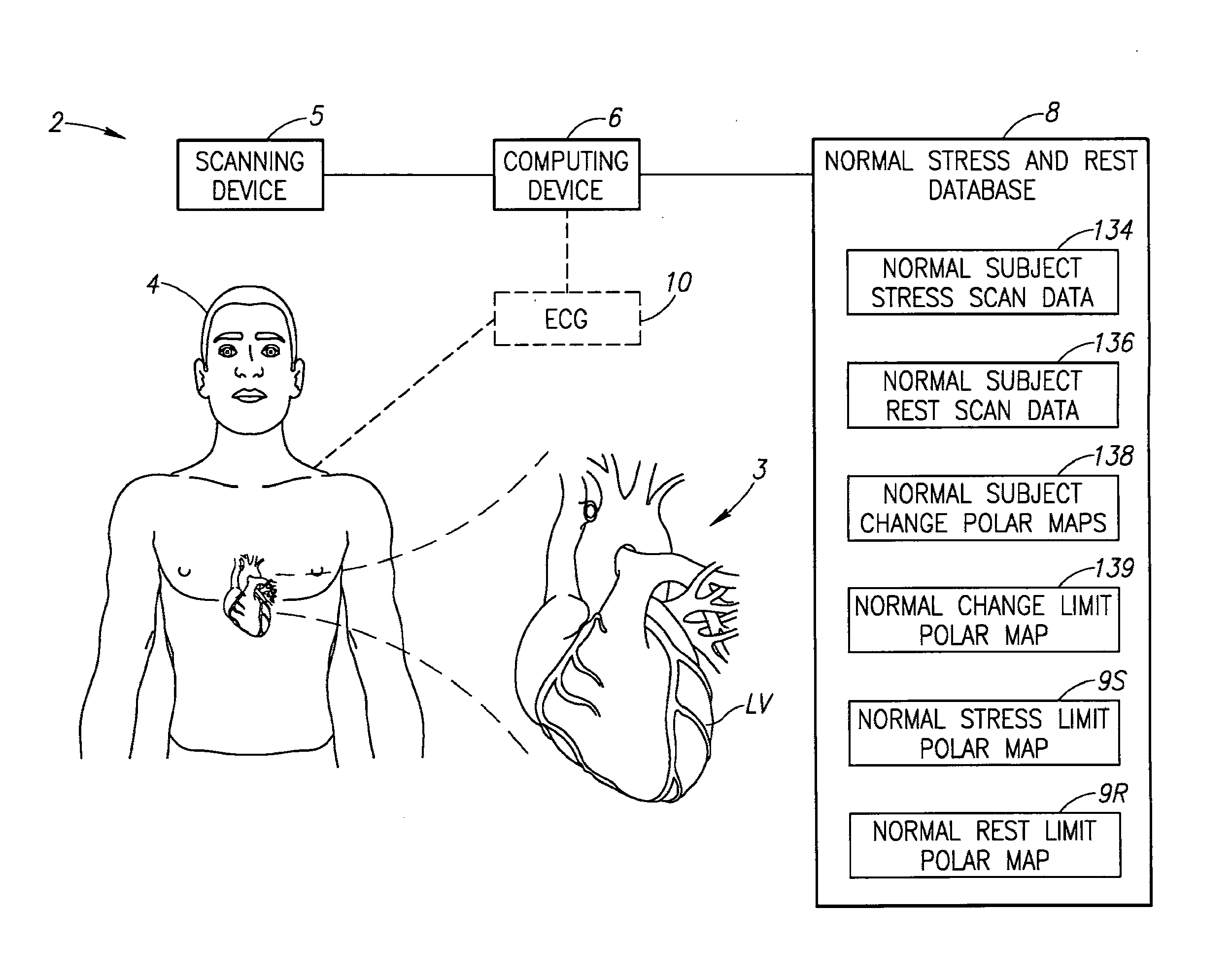 Method of determining ischemia using paired stress and rest scans