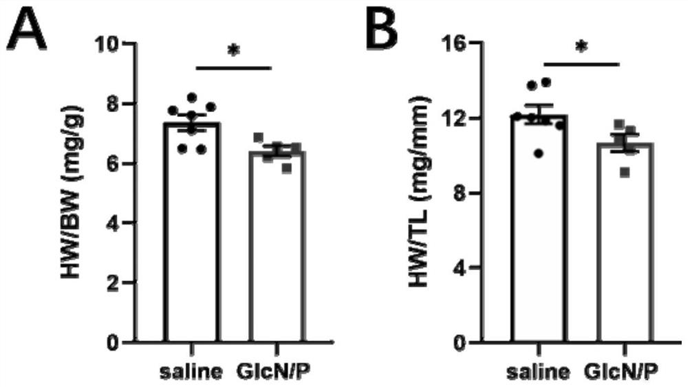 Medicine for preventing and treating heart failure after myocardial ischemia and application thereof