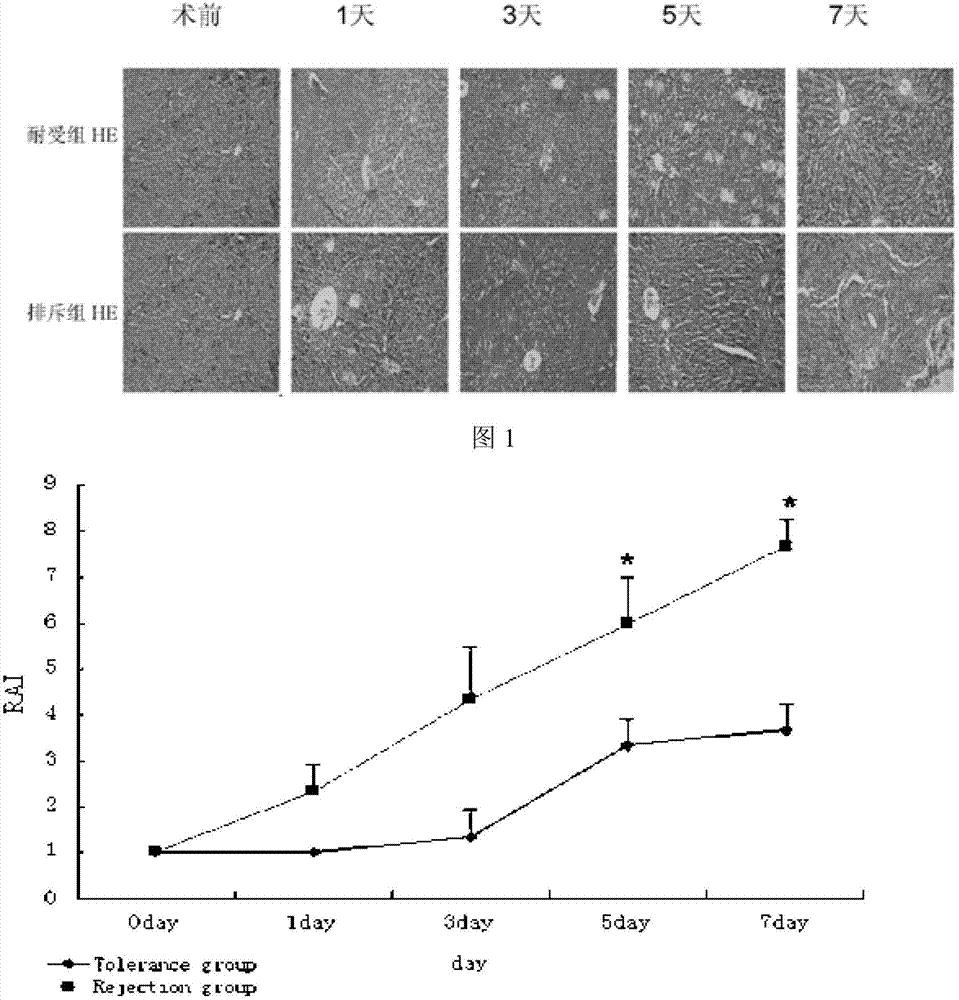 Application of human interleukin 22 in preparation of marker for liver transplantation rejection reaction