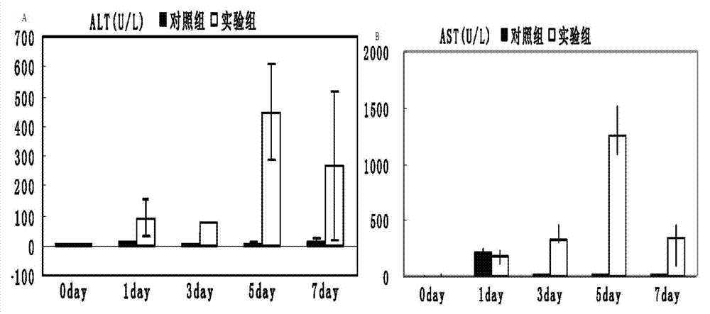 Application of human interleukin 22 in preparation of marker for liver transplantation rejection reaction