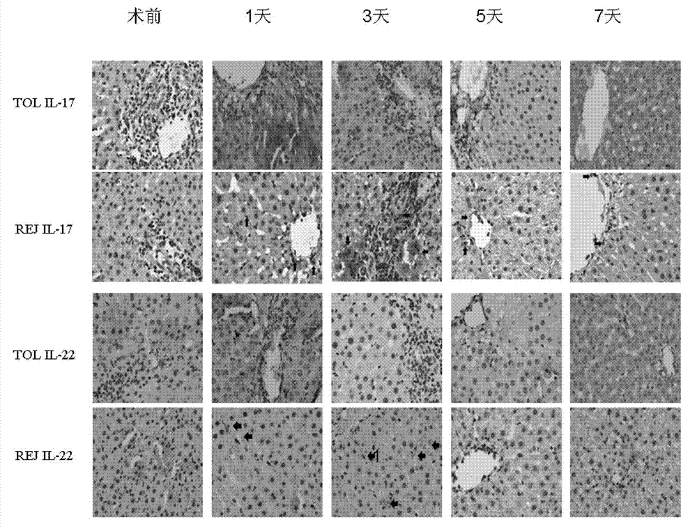 Application of human interleukin 22 in preparation of marker for liver transplantation rejection reaction