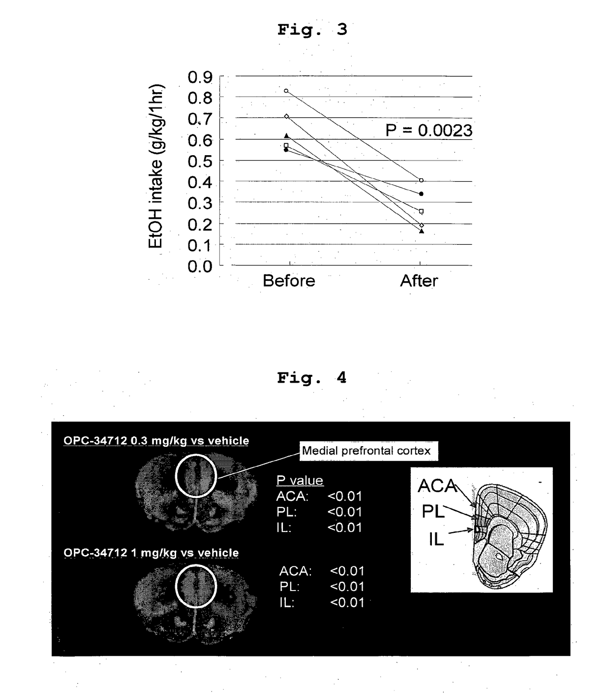 Prophylactic and/or therapeutic agent for behavioral and psychological symptoms associated with neurodegenerative disease or impulsive symptoms associated with mental disease containing brexpiprazole or salt thereof