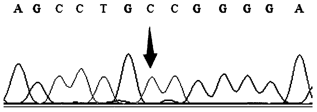 Gene detection kit for detecting individual drug use of tacrolimus drug