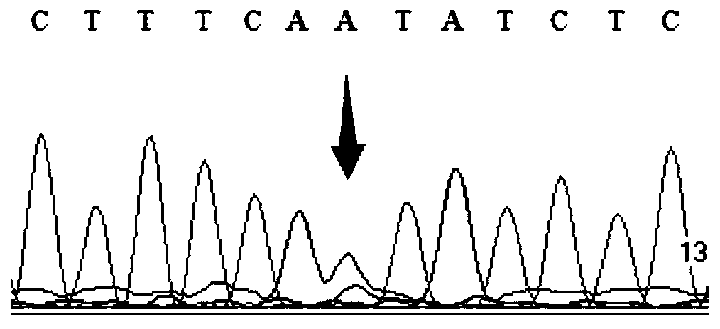 Gene detection kit for detecting individual drug use of tacrolimus drug