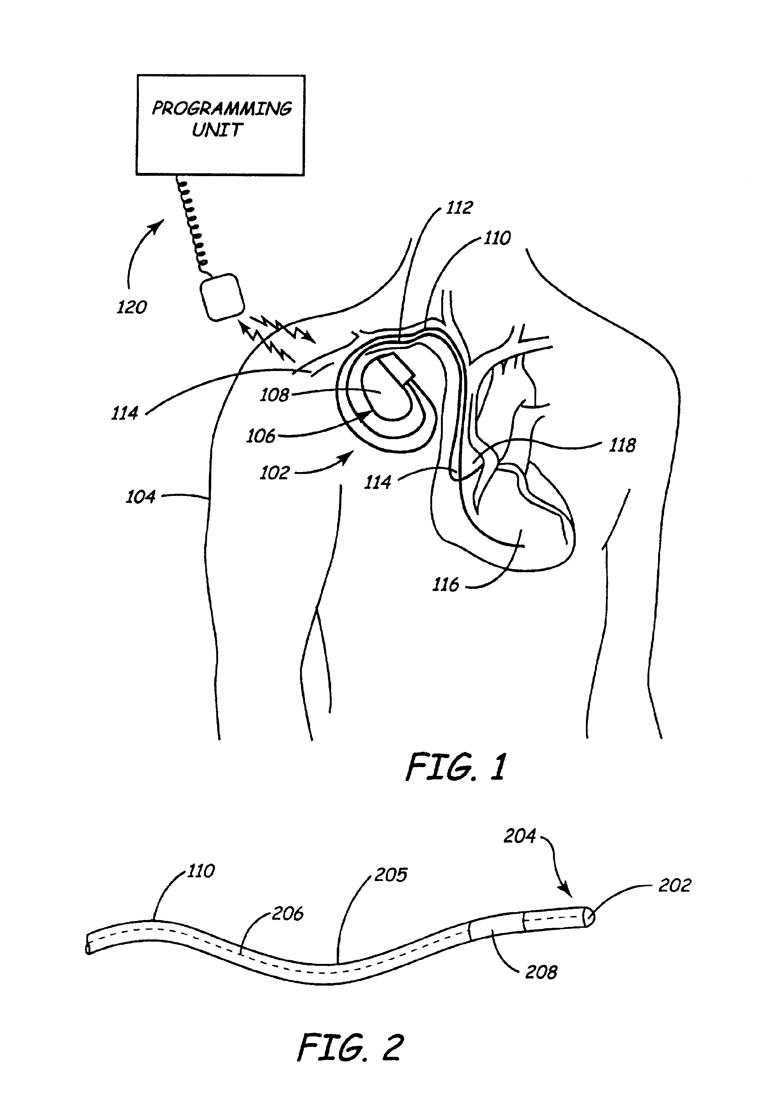 Method and apparatus for shunting induced currents in an electrical lead