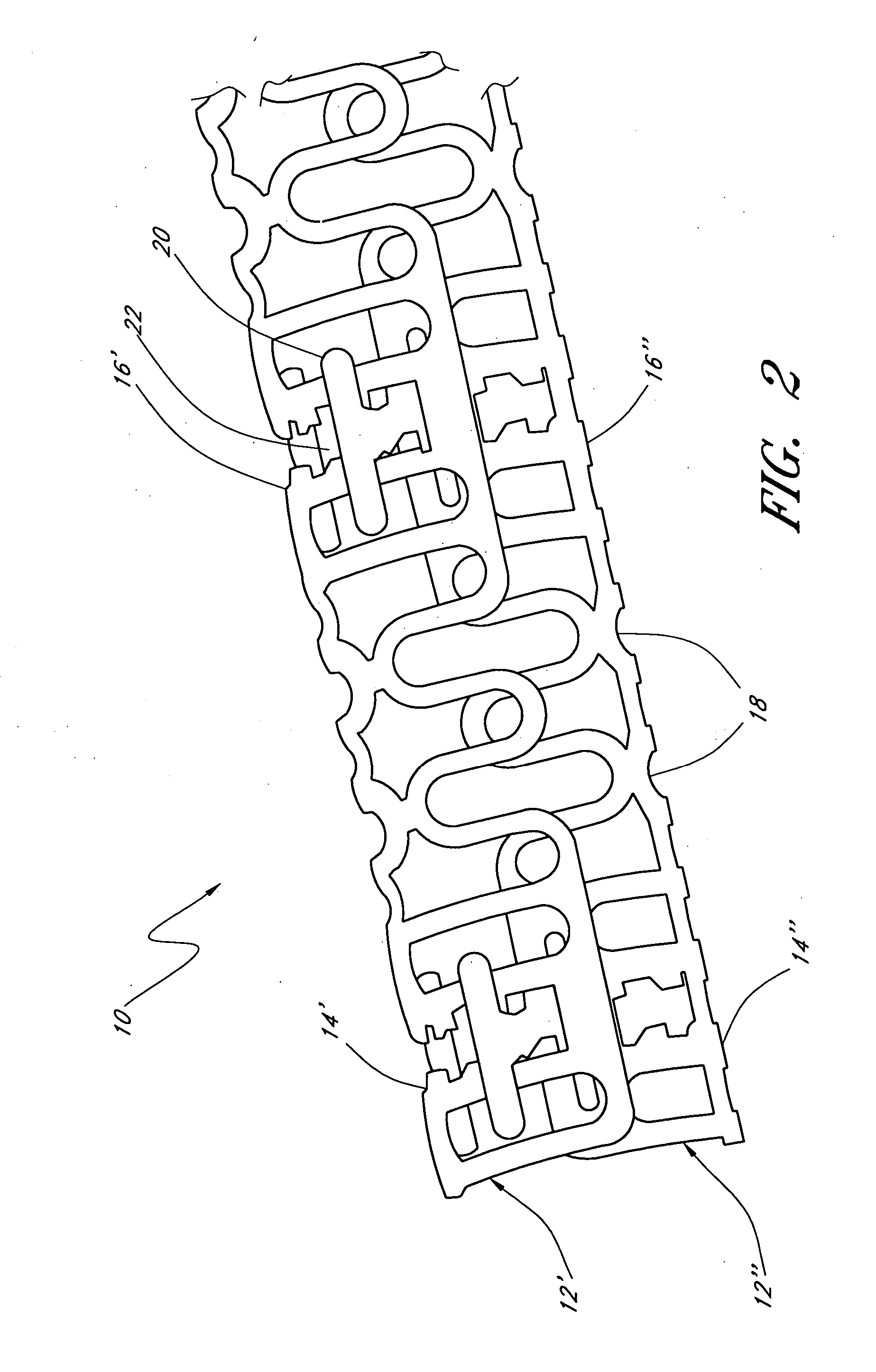 Slide-and-lock stent