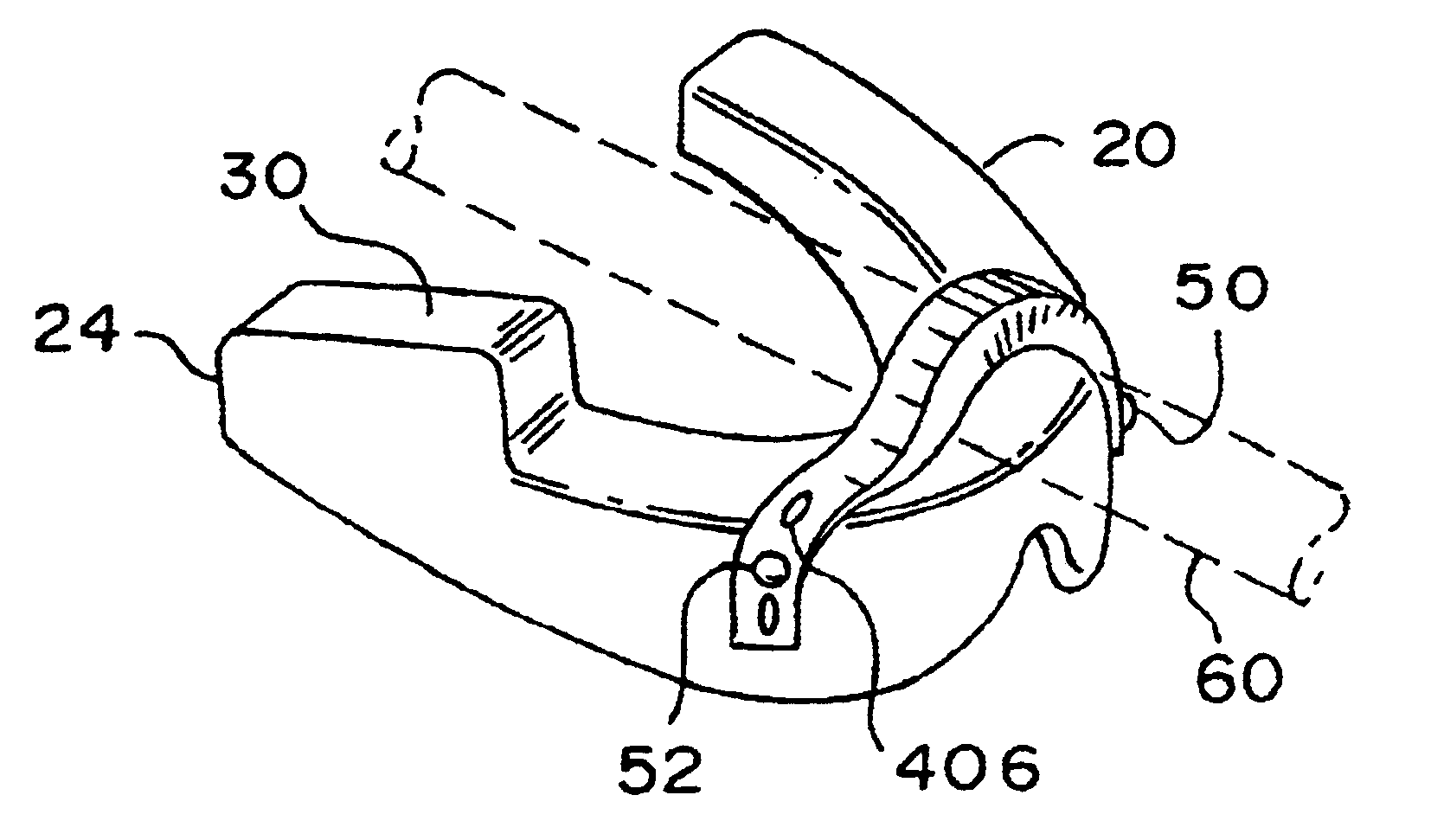 Catheter securing device