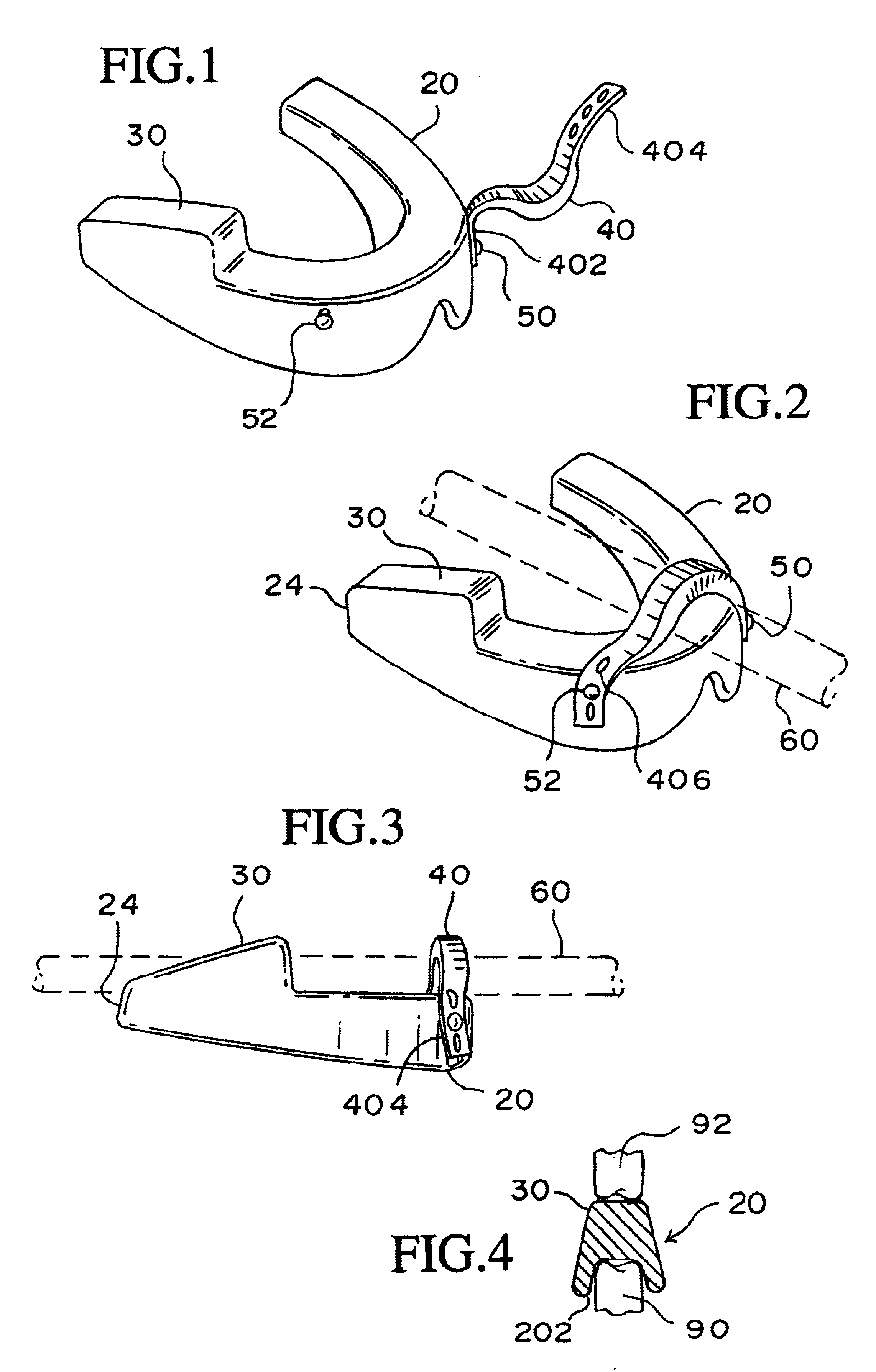 Catheter securing device