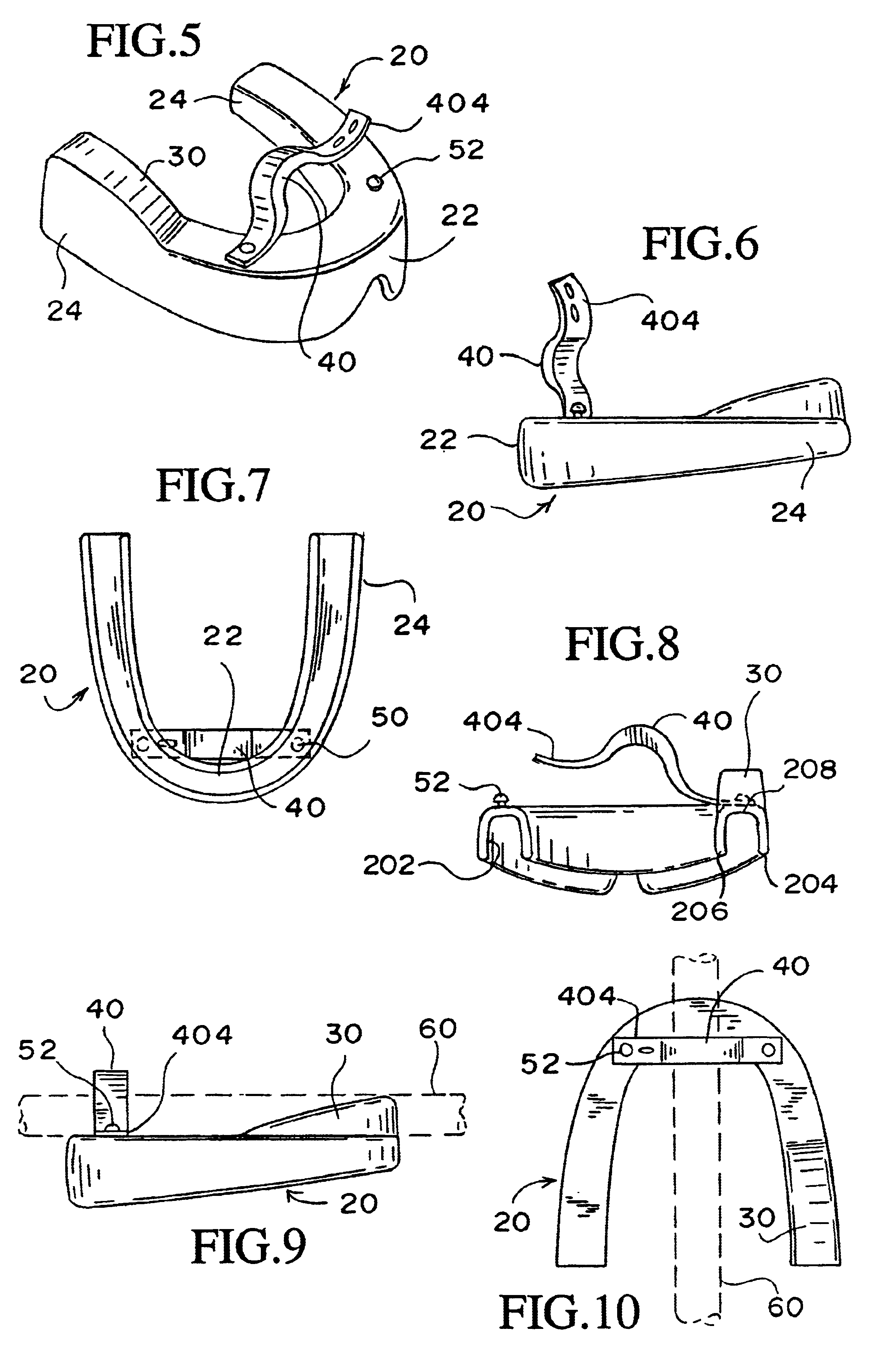 Catheter securing device