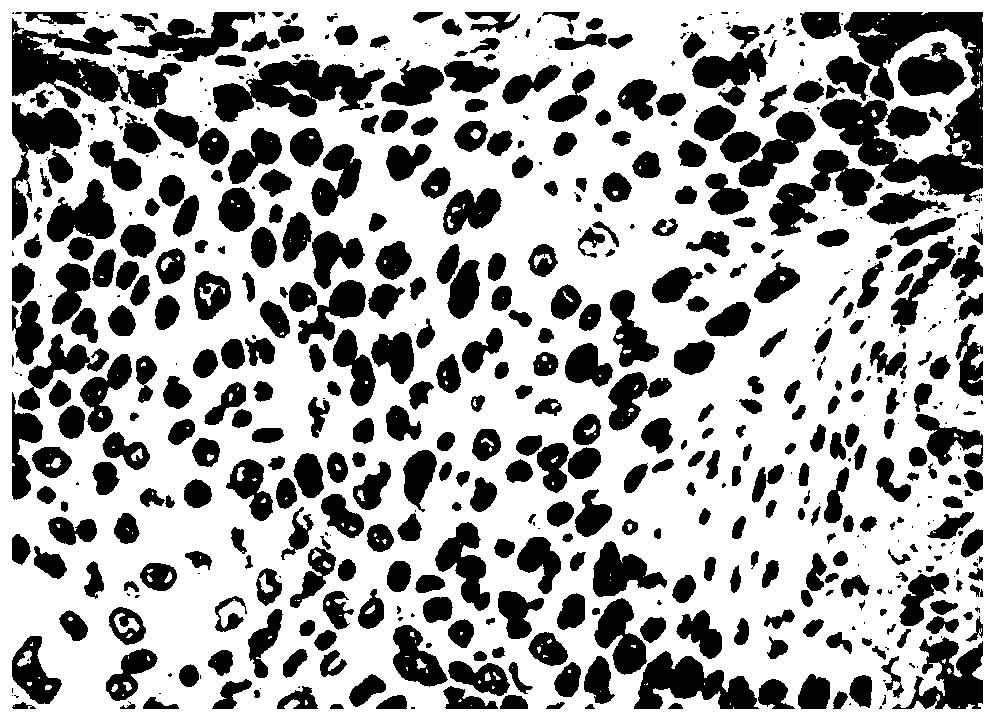 Ki67 cell nucleus counting method and system based on pathological immunohistochemistry