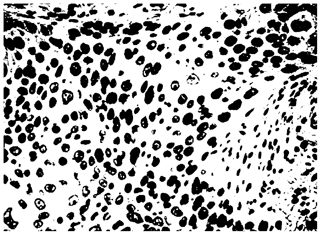 Ki67 cell nucleus counting method and system based on pathological immunohistochemistry