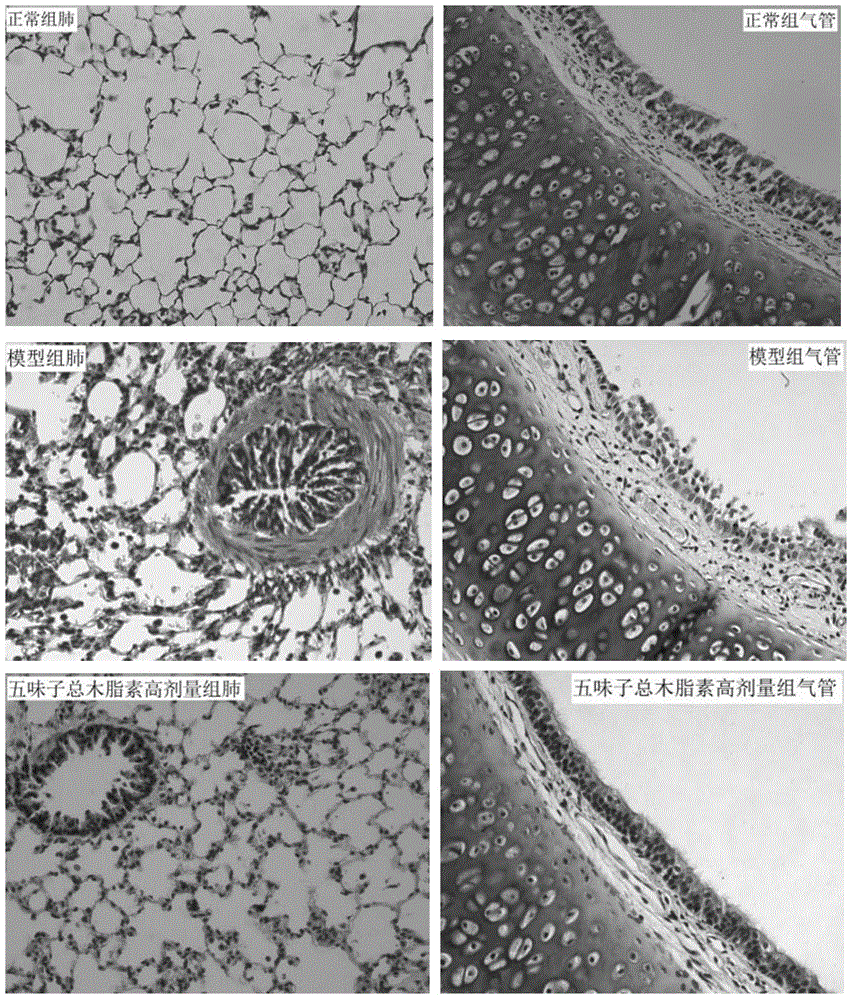 Application of total schisandra lignans in preparation of medicaments or health-care products for treating cough