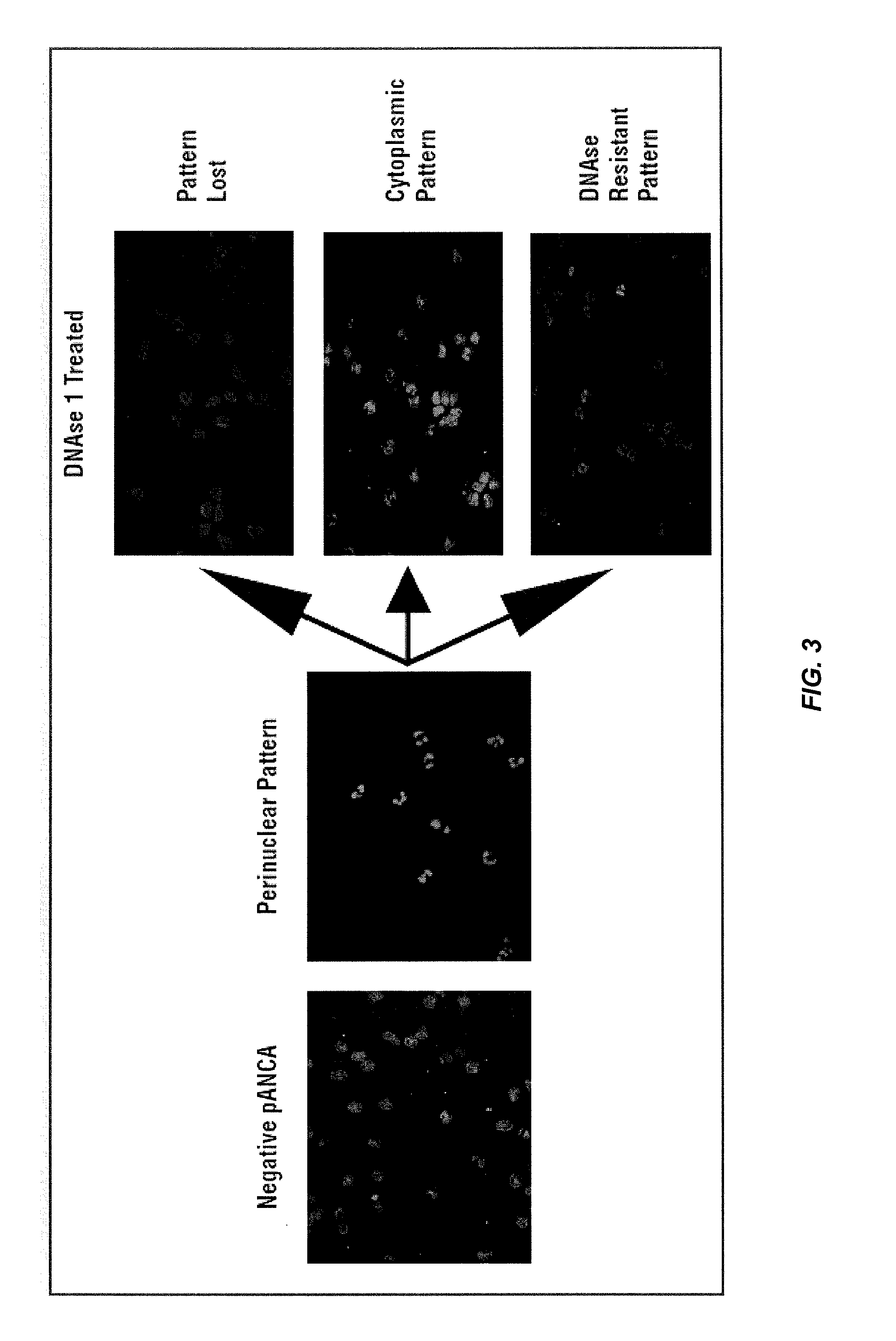 Methods for improving inflammatory bowel disease diagnosis