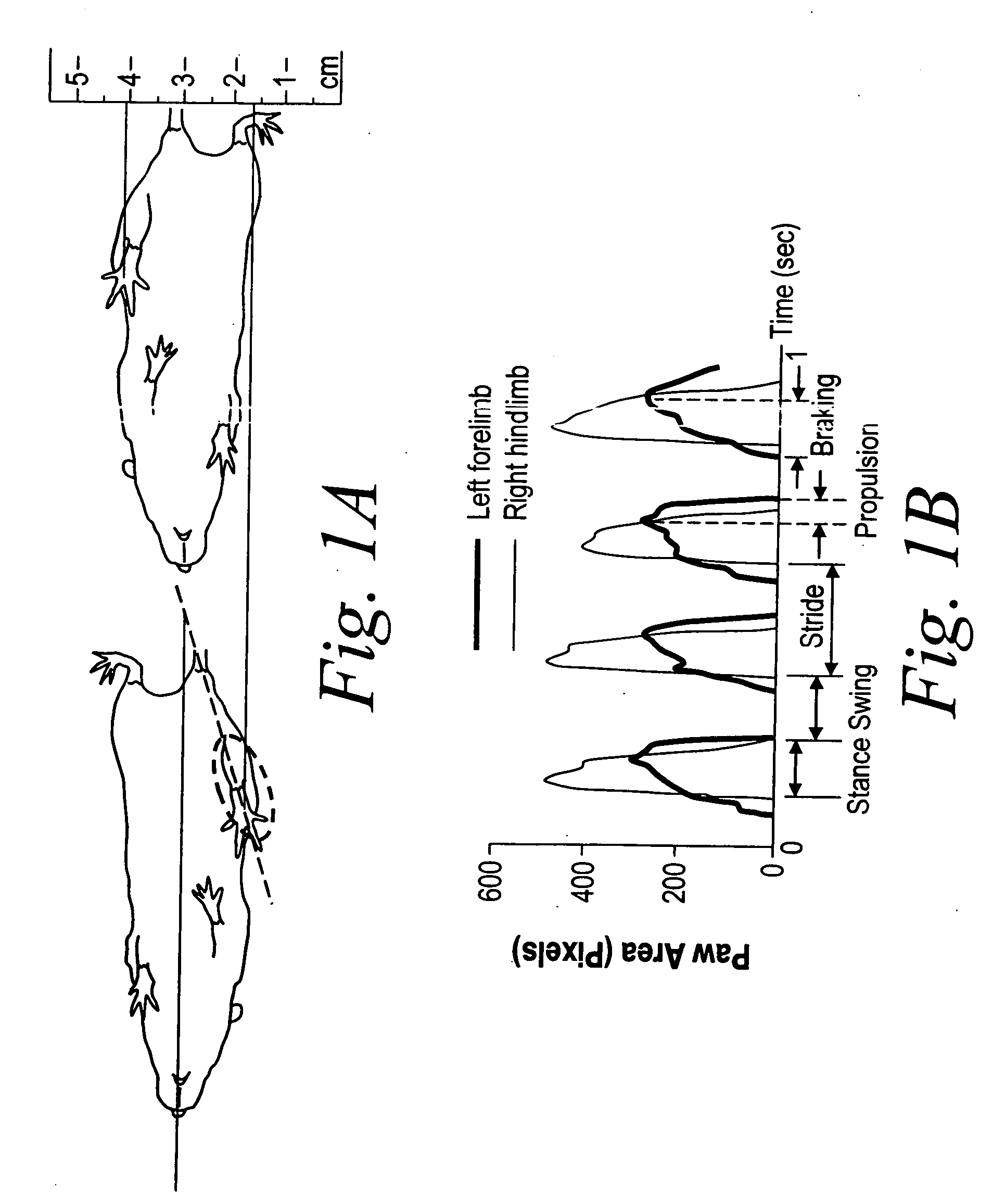 Measurement of gait dynamics and use of beta-blockers to detect, prognose, prevent and treat amyotrophic lateral sclerosis