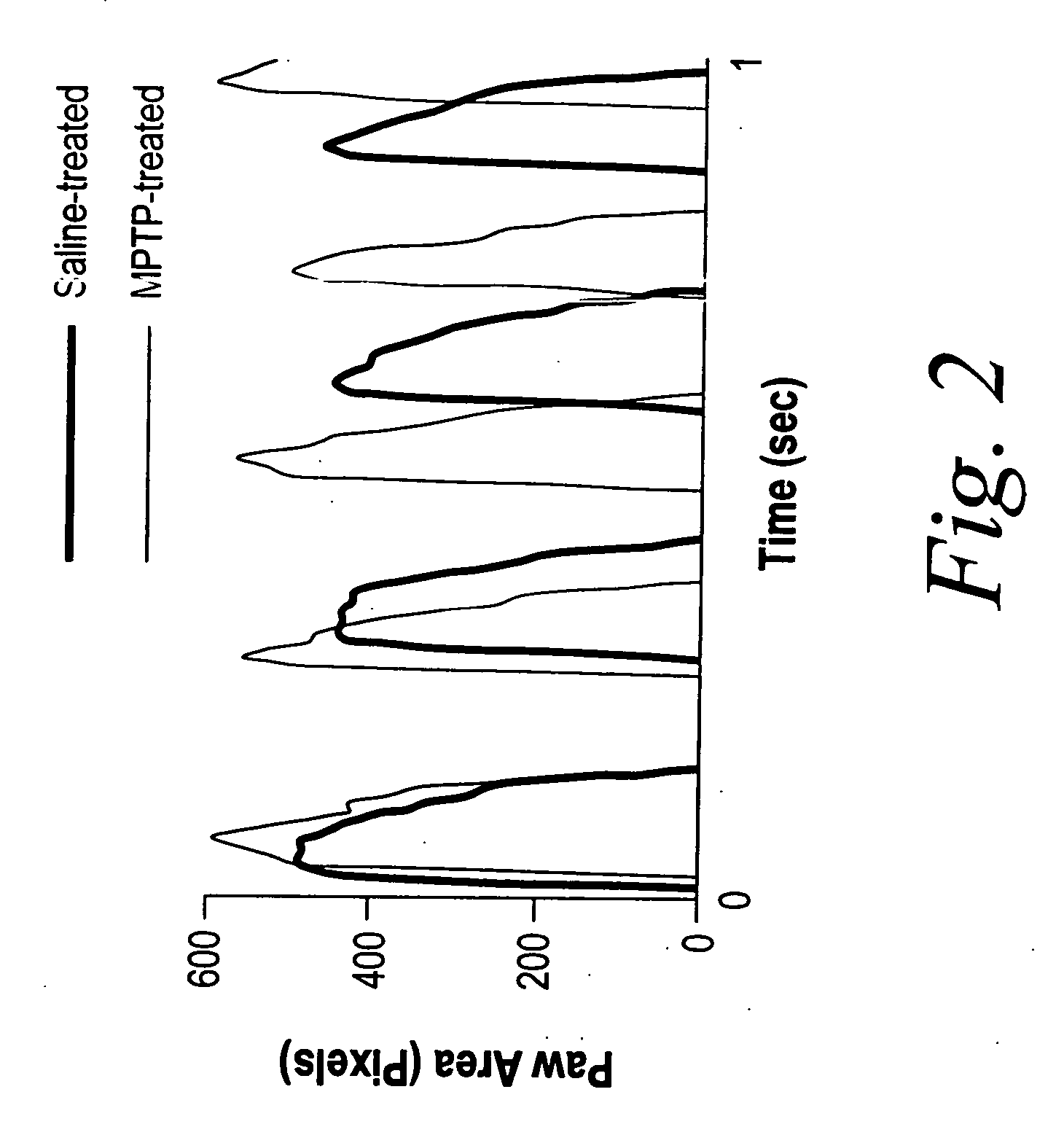 Measurement of gait dynamics and use of beta-blockers to detect, prognose, prevent and treat amyotrophic lateral sclerosis