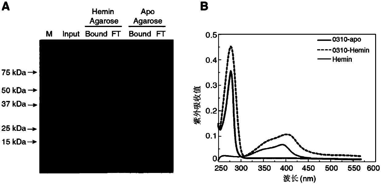 Application of SPD_0310 protein as target spot in preparation of medicine for preventing and treating streptococcus pneumoniae infection