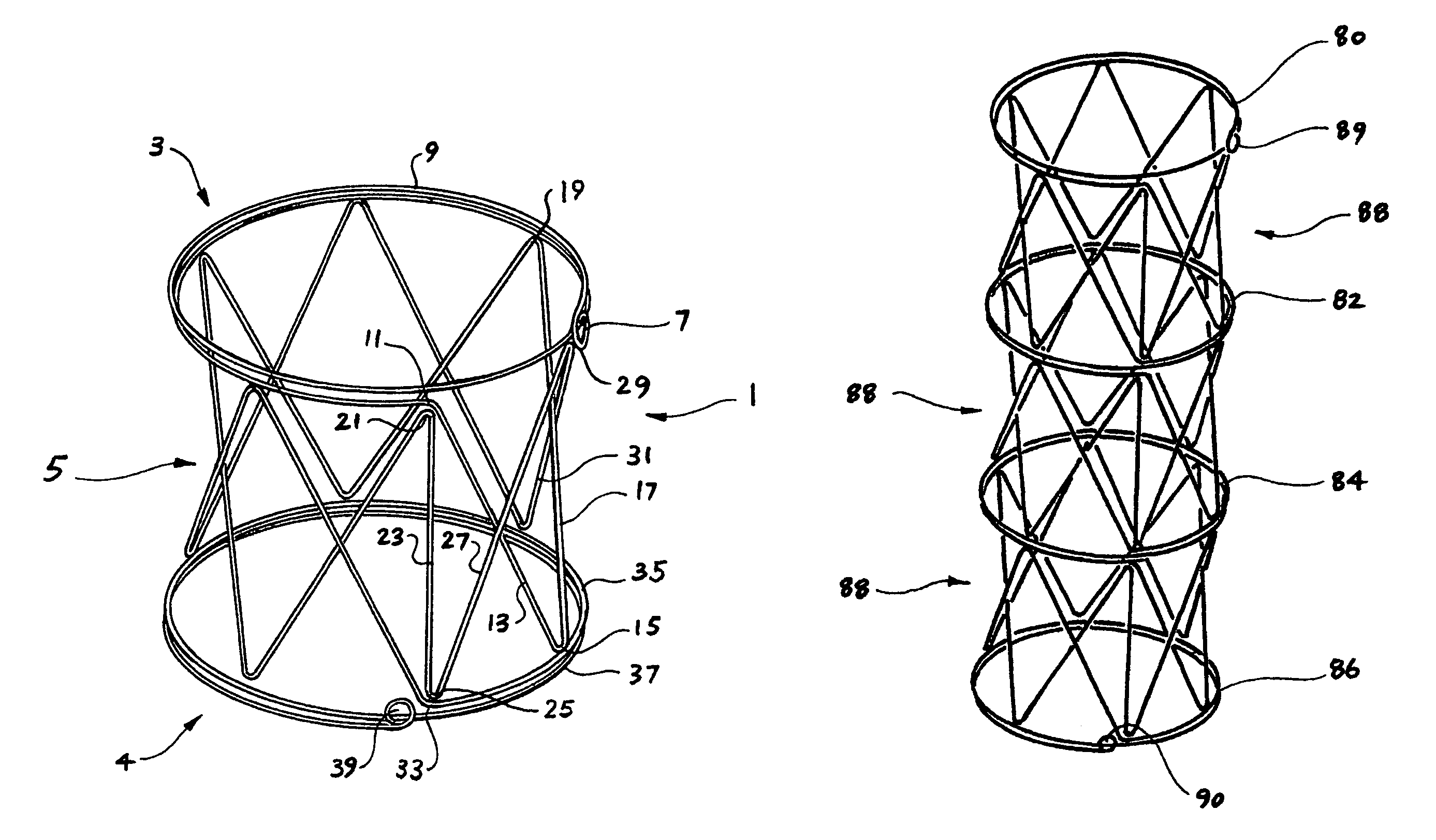 Ring stent