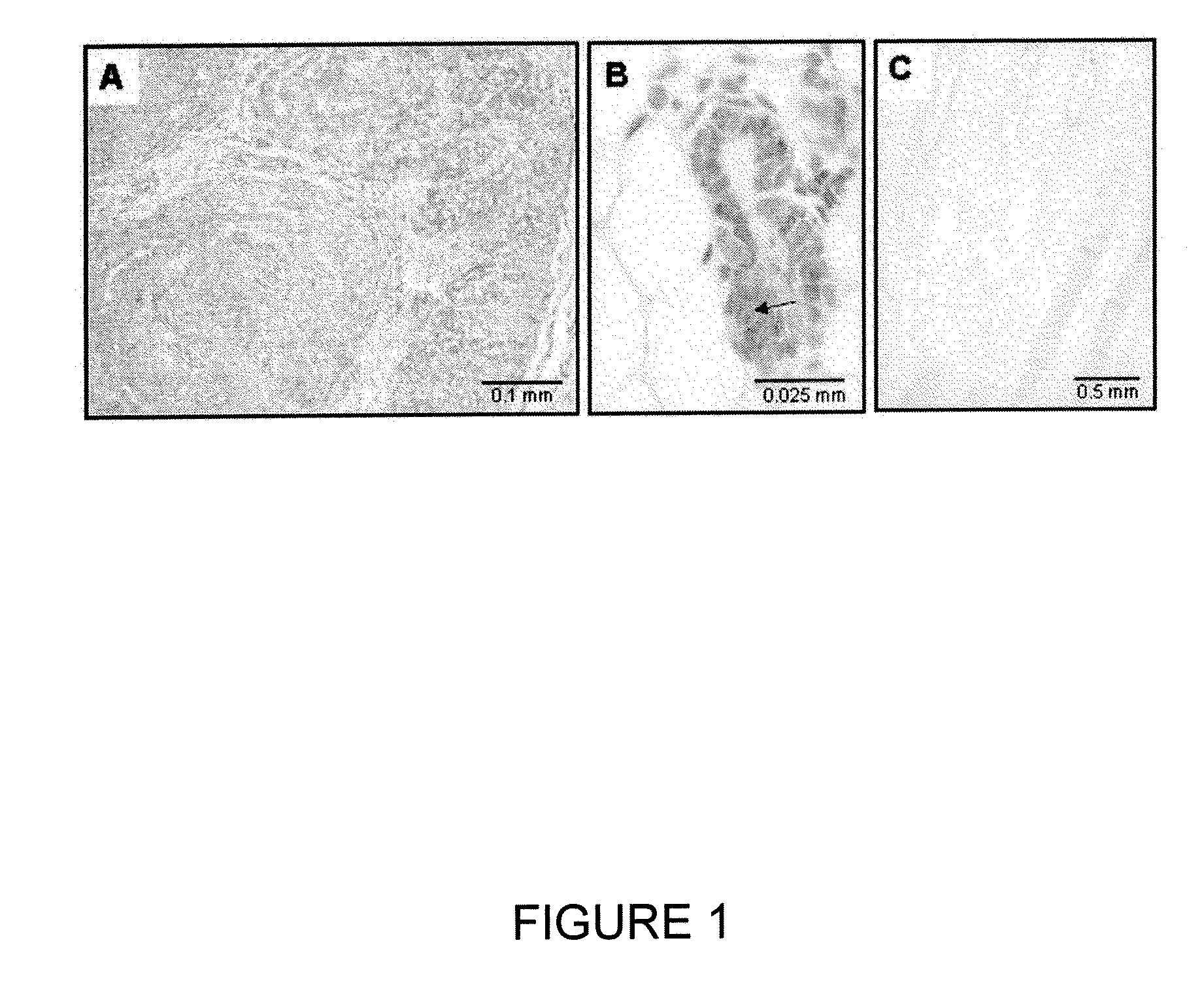 Low-density lipoprotein receptor 6 (LRP6) as a mammary stem cell marker and related methods