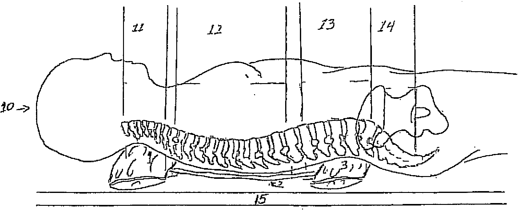 Therapeutic Neutral Spine and Exercise Device and Method of Applying Same