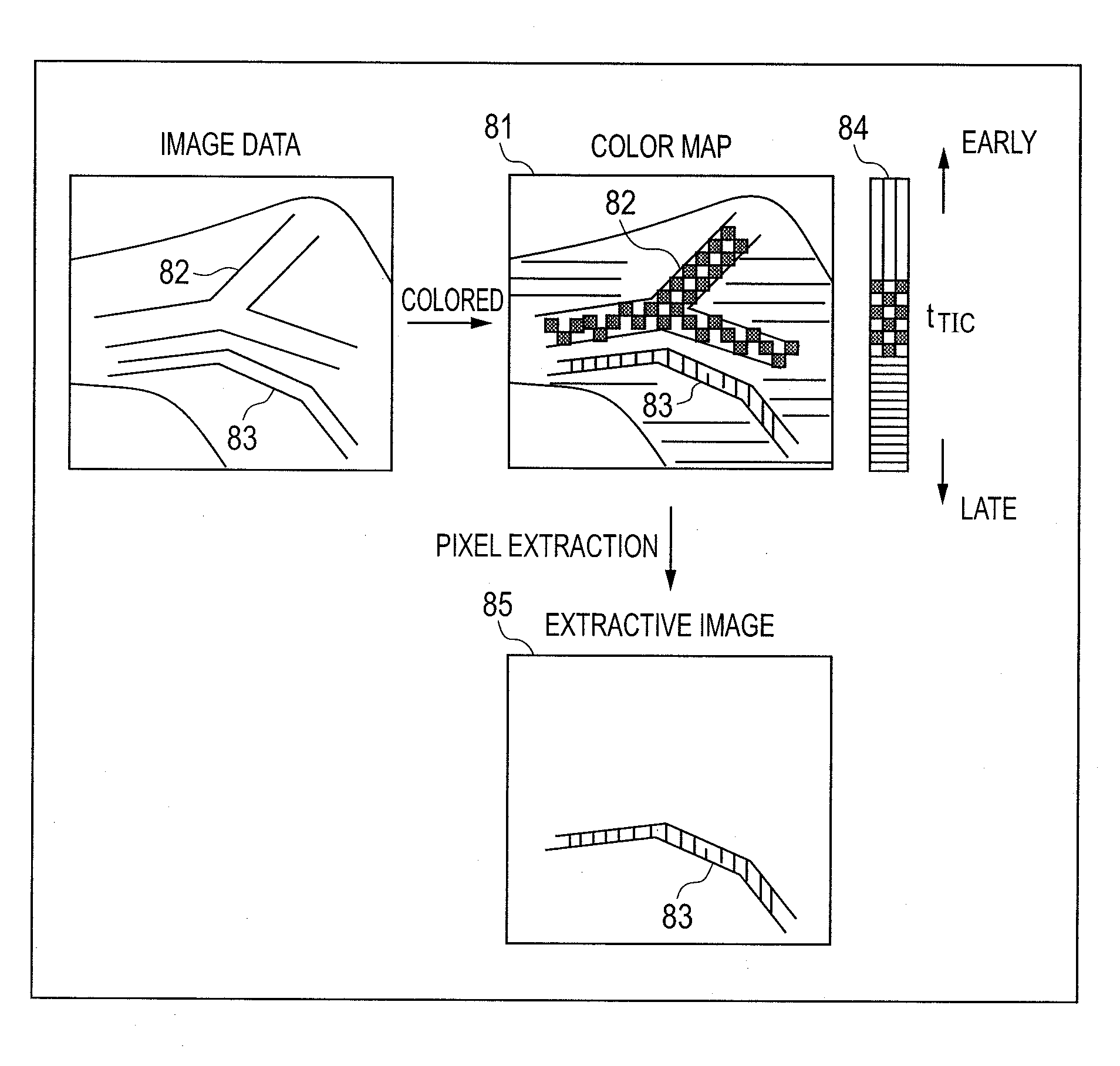 Ultrasonic imaging apparatus