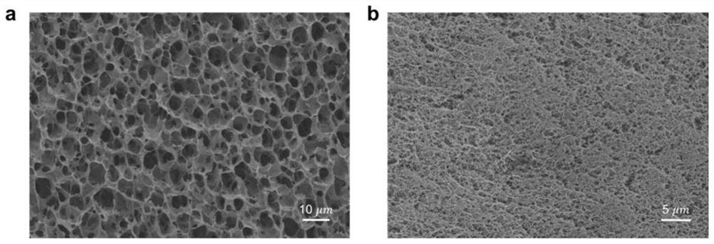 A chitosan-based pure physical cross-linked double network hydrogel and preparation method thereof