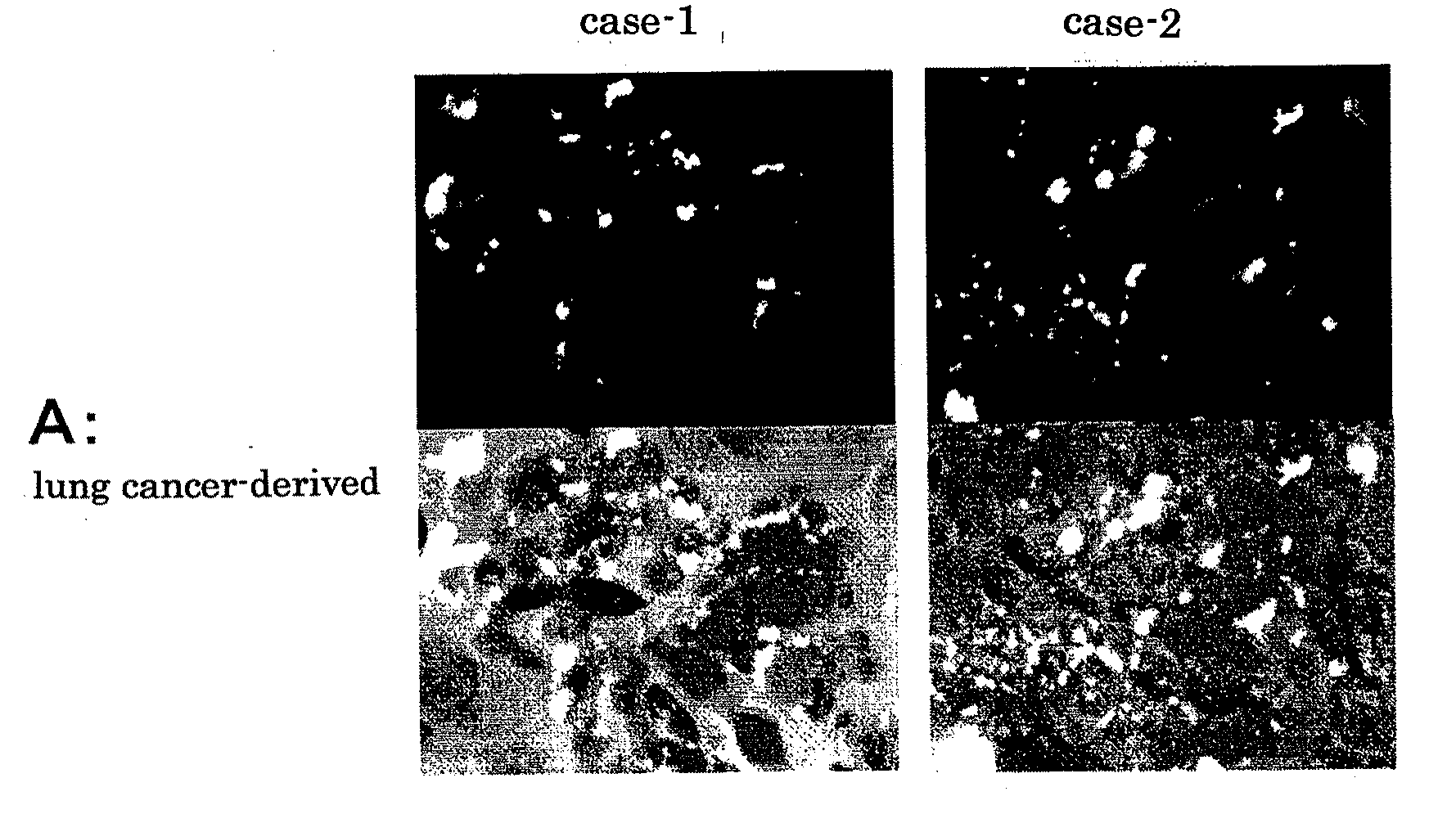 Monoclonal antibody, gene encoding the antibody, hybridoma, pharmaceutical composition, and diagnostic reagent