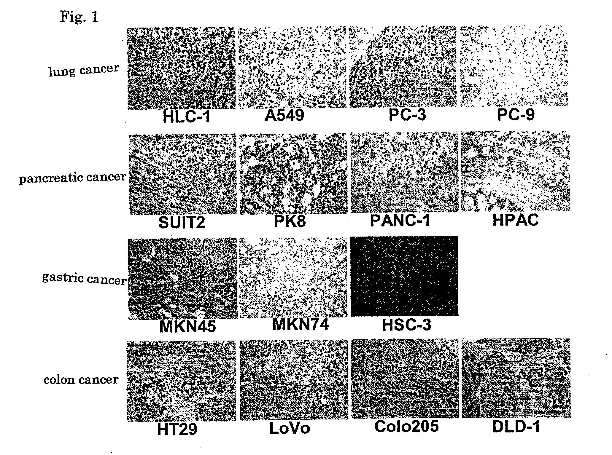 Monoclonal antibody, gene encoding the antibody, hybridoma, pharmaceutical composition, and diagnostic reagent