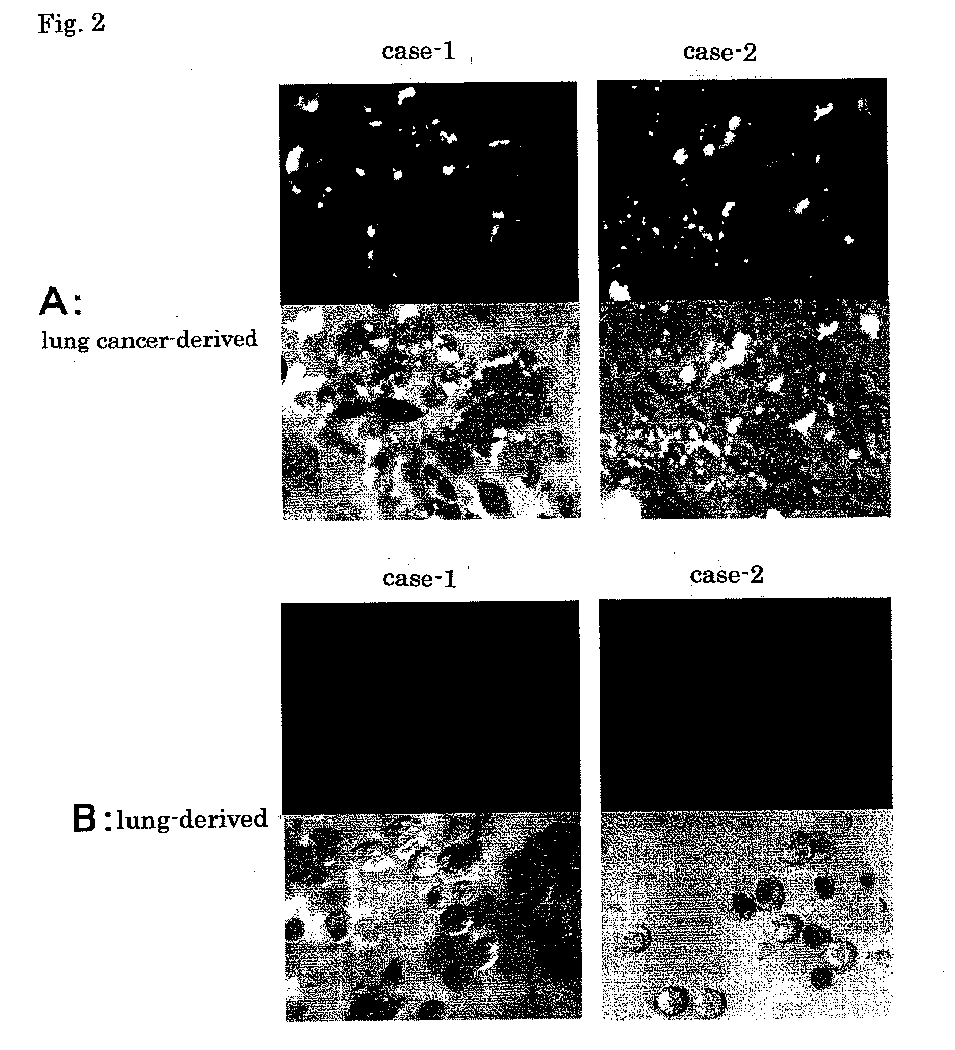 Monoclonal antibody, gene encoding the antibody, hybridoma, pharmaceutical composition, and diagnostic reagent