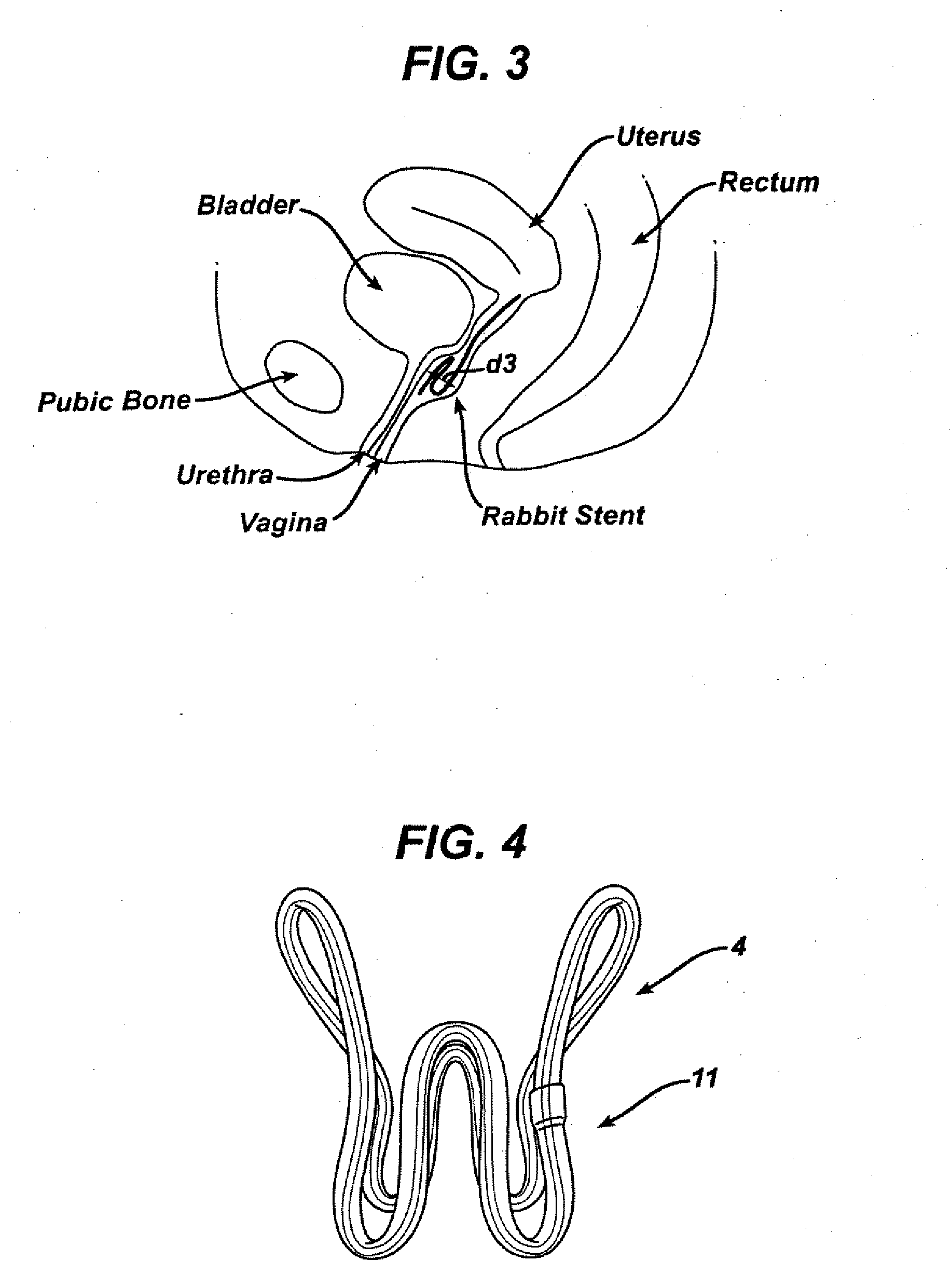 Resilient device