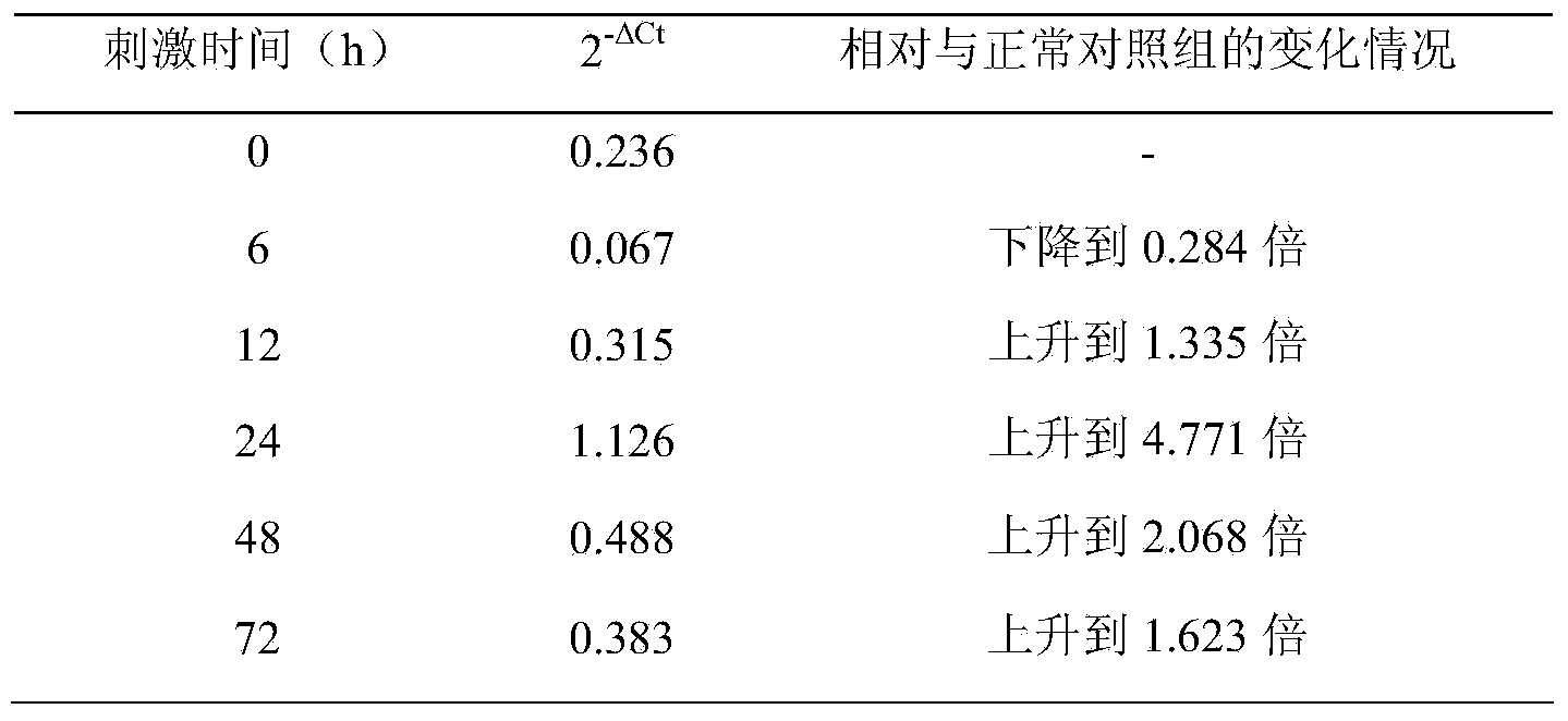 Method for evaluating water quality by use of MT (metallothionein) gene expression mode of freshwater crayfish