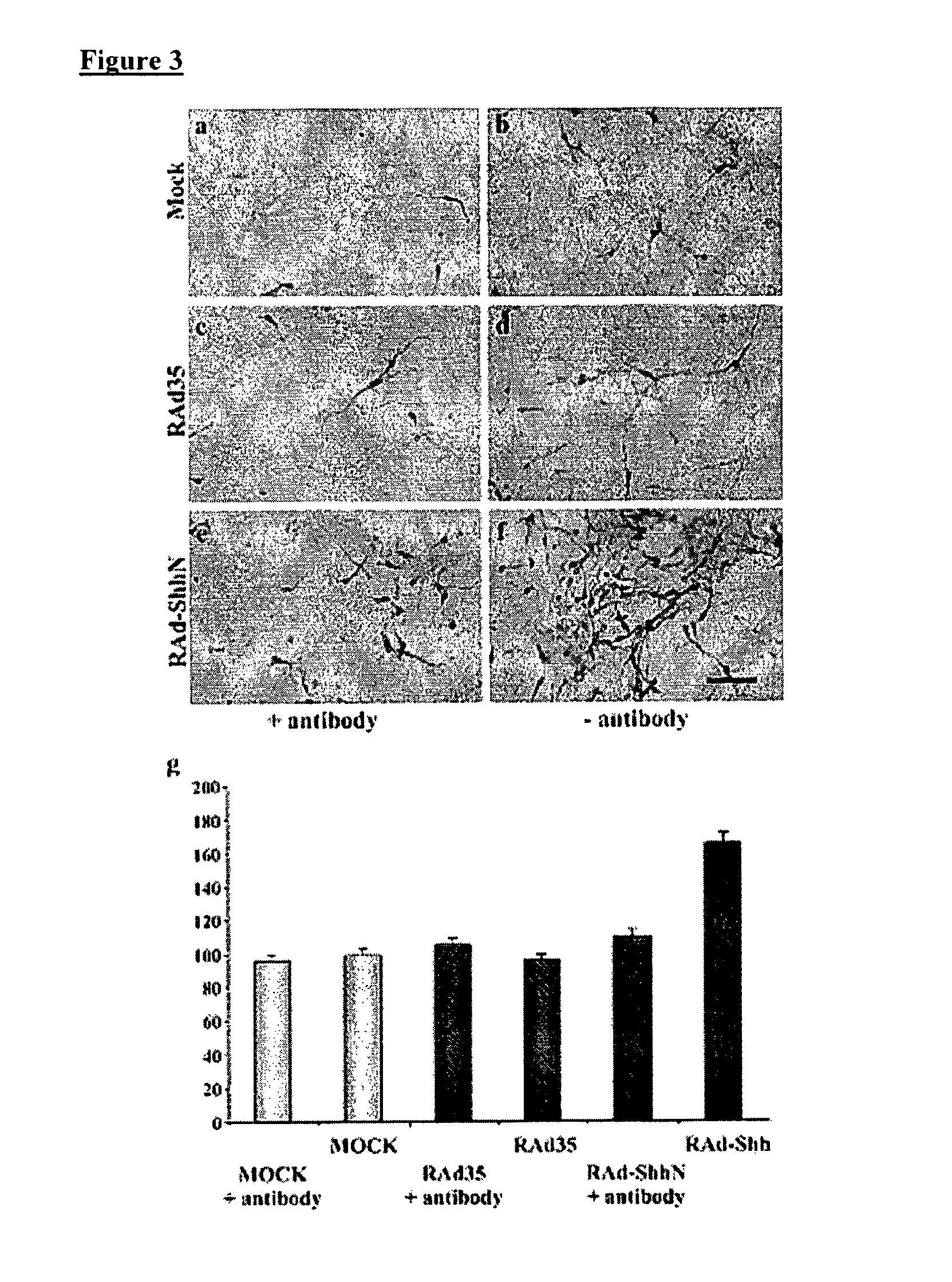 Treatment of parkinson's disease and related disorders