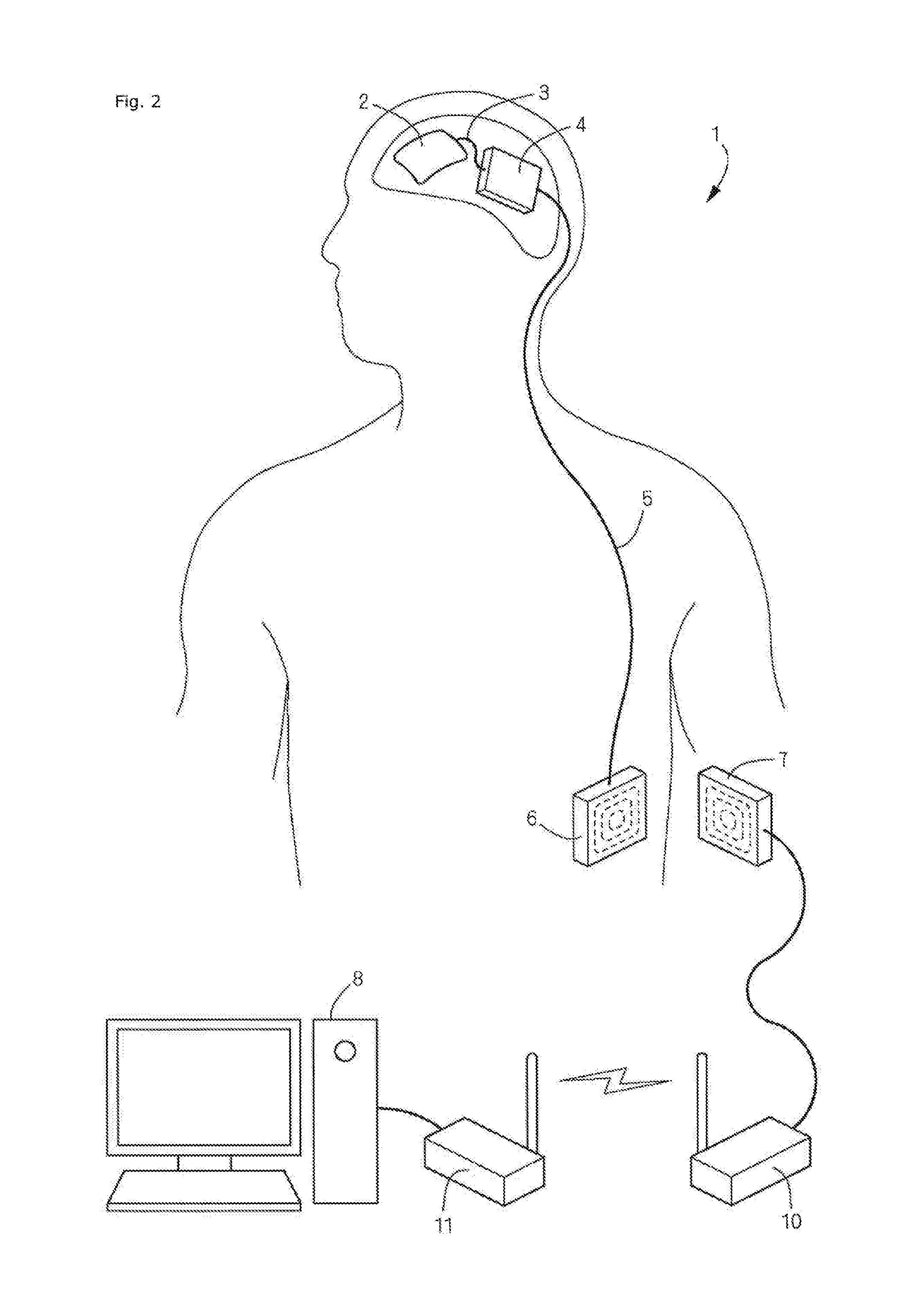 Casing of implantable device and implantable device, method for manufacturing casing of implantable device, and method for supporting treatment using implantable device