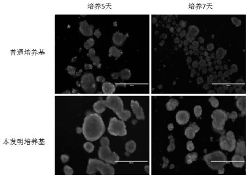 Young pig islet cell culture medium and application method thereof