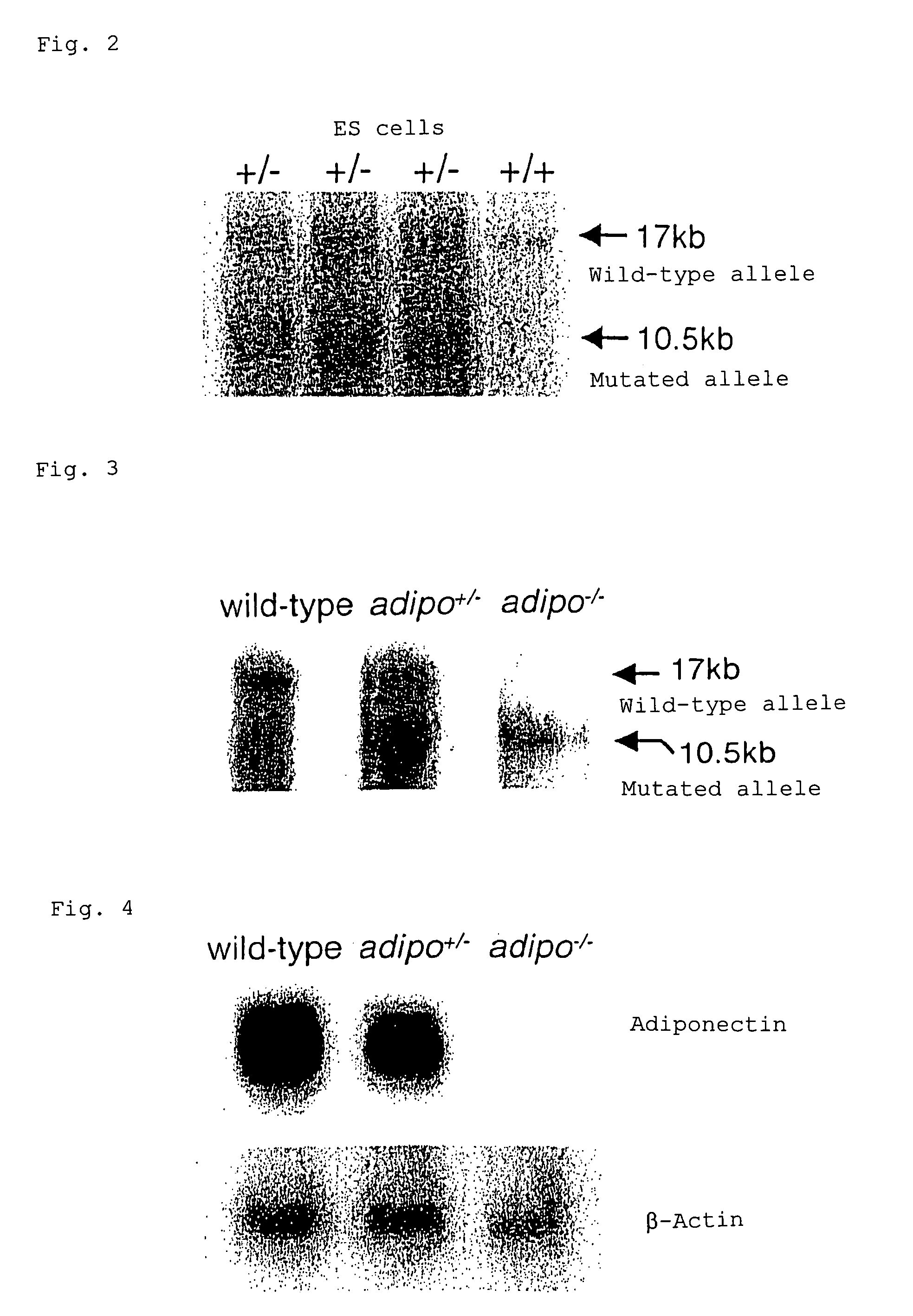 Method for treating arteriosclerosis