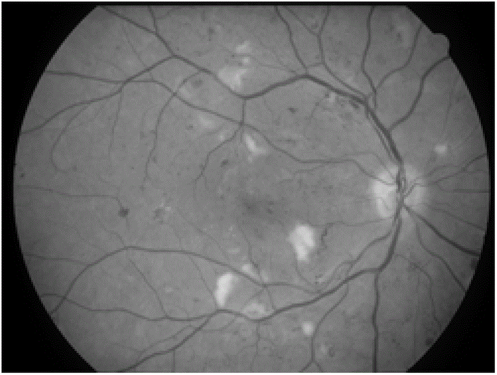 Fuzzy clustering image segmenting method