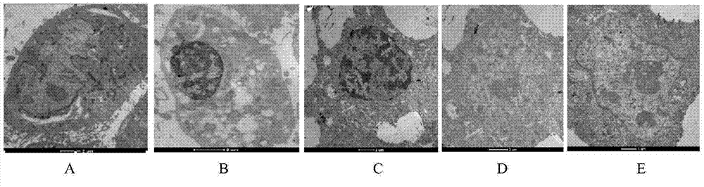 Application method of astragalus polysaccharide in antagonism of dairy cow mammary epithelial cells apoptosis