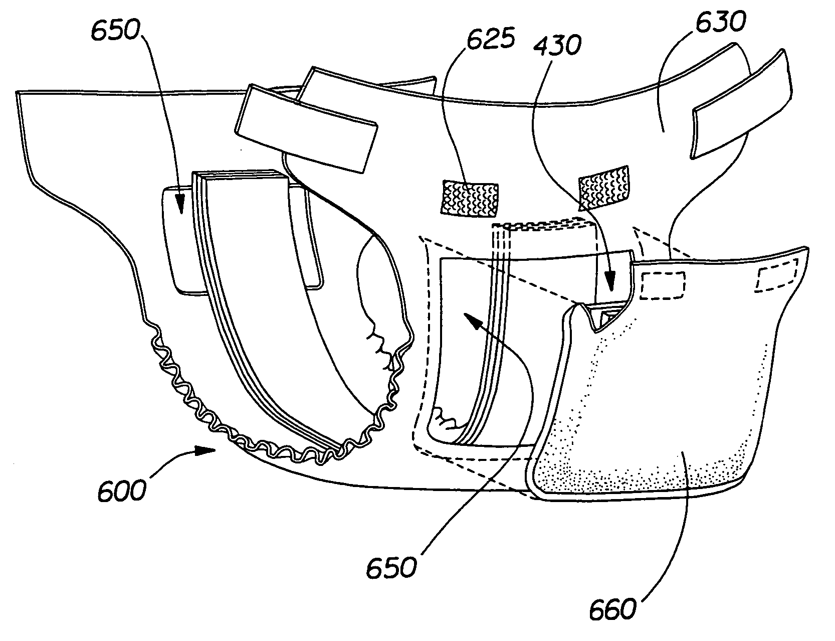 Absorbent article having a replaceable absorbent core component having an insertion pocket