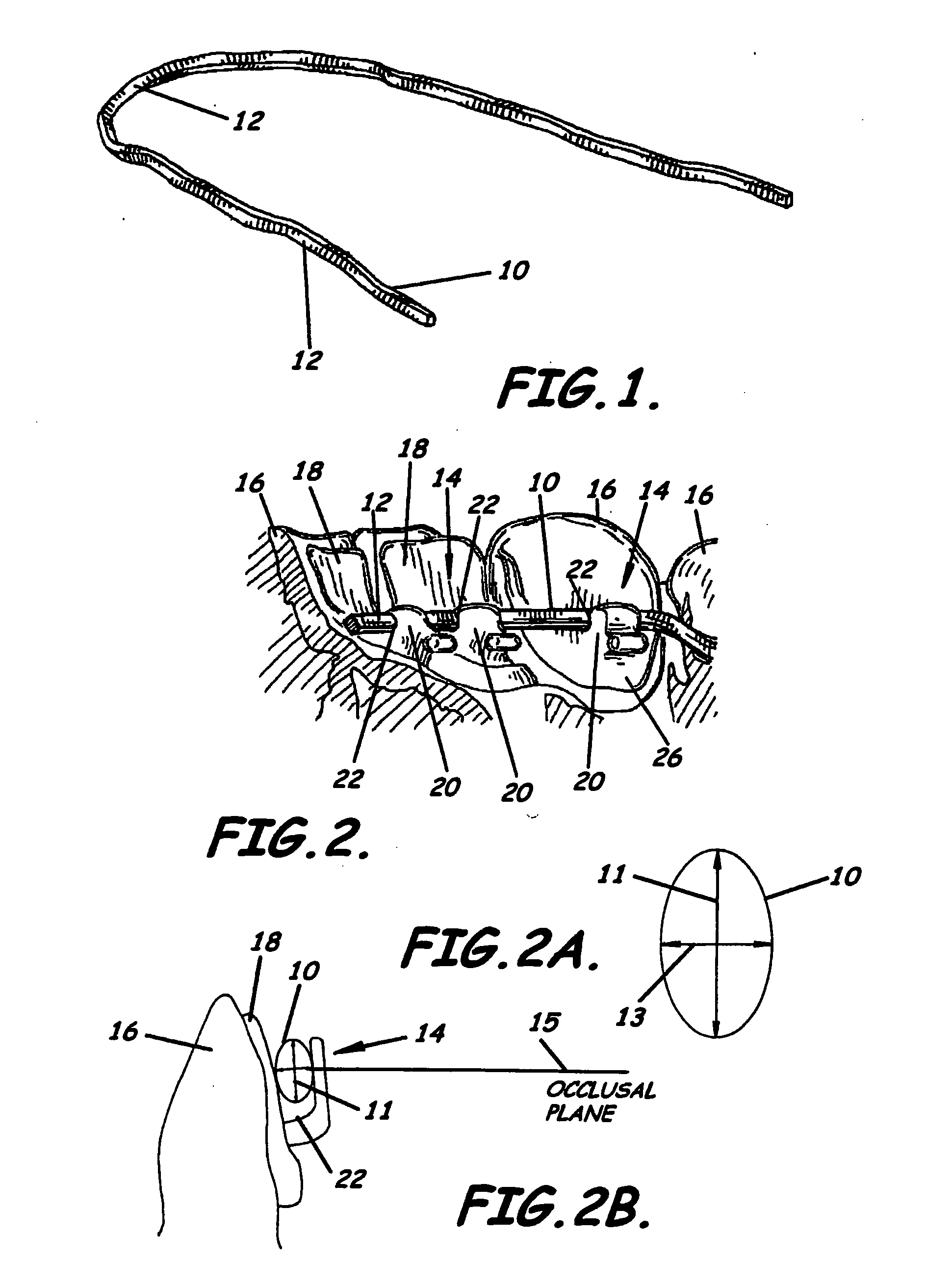 Modular system for customized orthodontic appliances