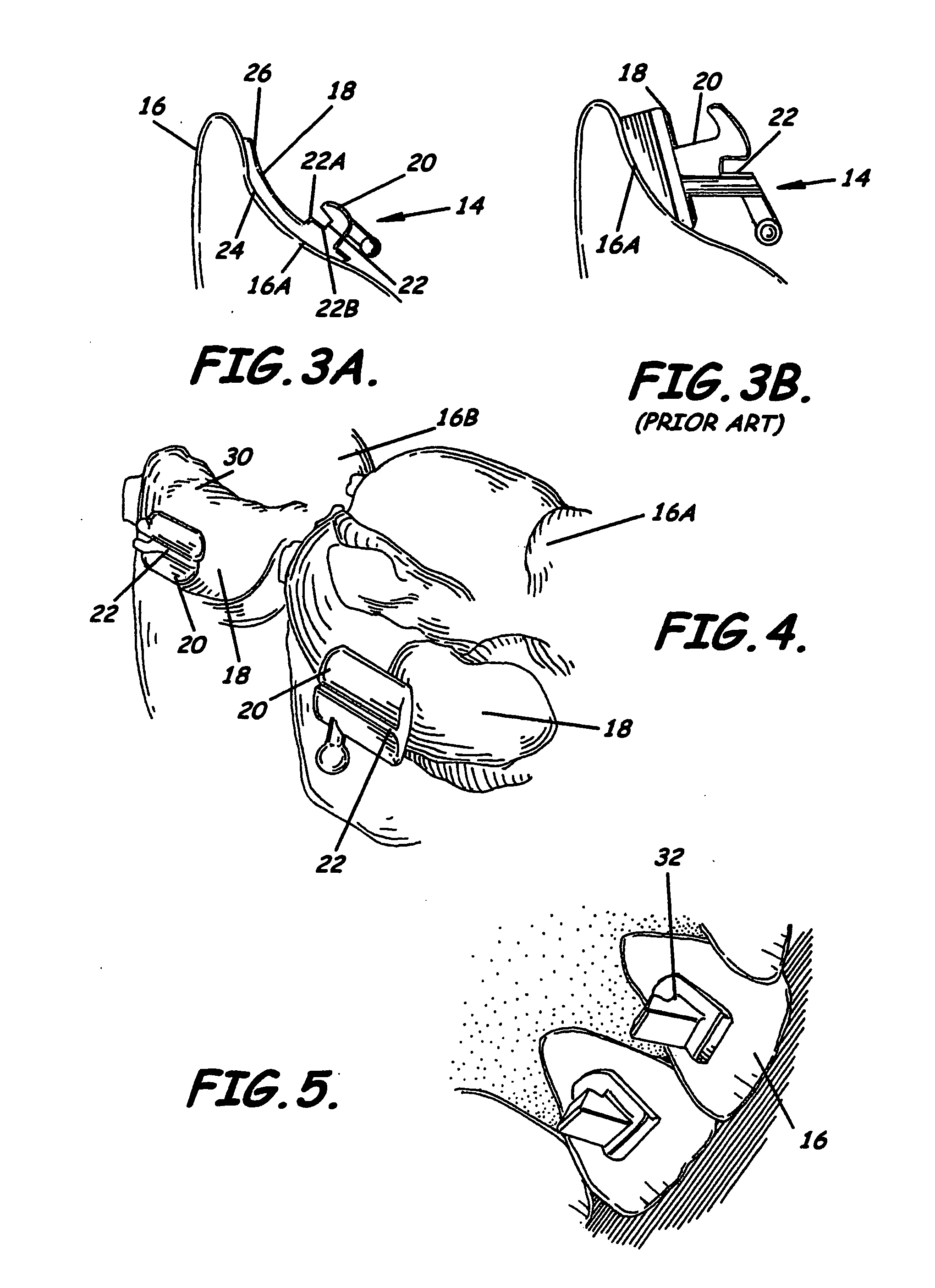 Modular system for customized orthodontic appliances