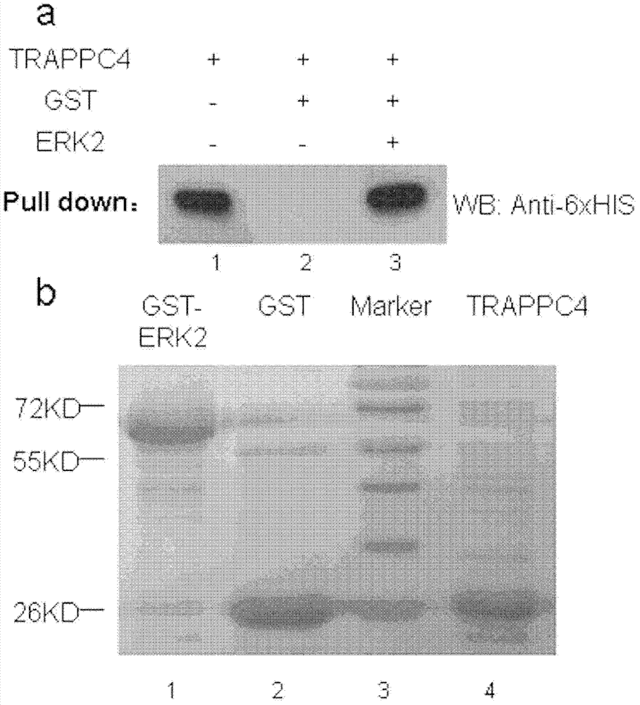 Small interfering RNA for TRAPPC4 gene target point, and uses thereof