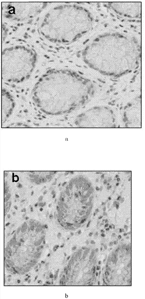 Small interfering RNA for TRAPPC4 gene target point, and uses thereof