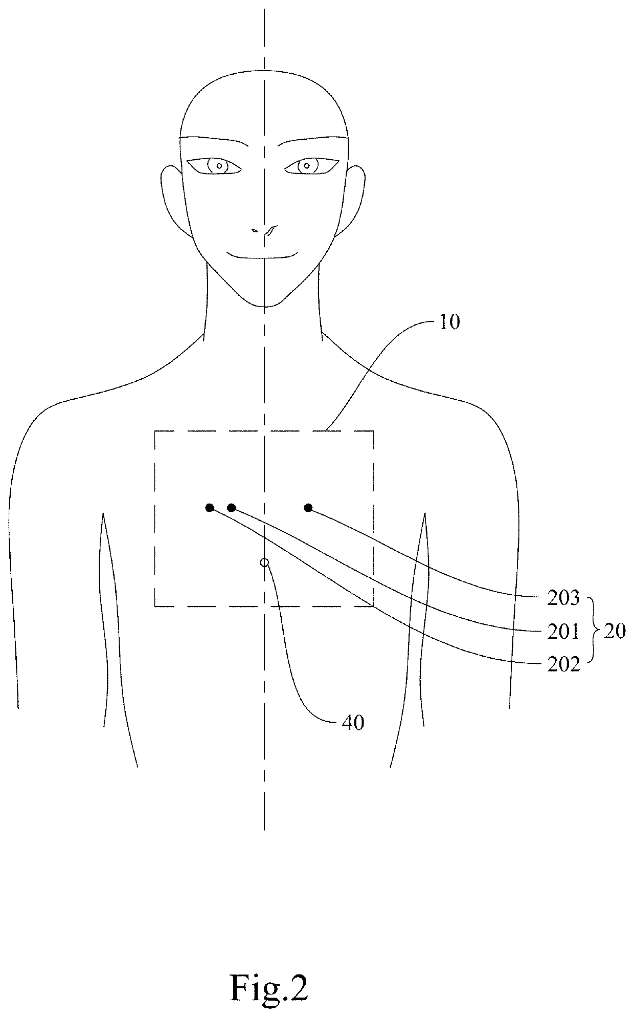 Electrocardographic monitoring device and blood pressure monitoring system using the same