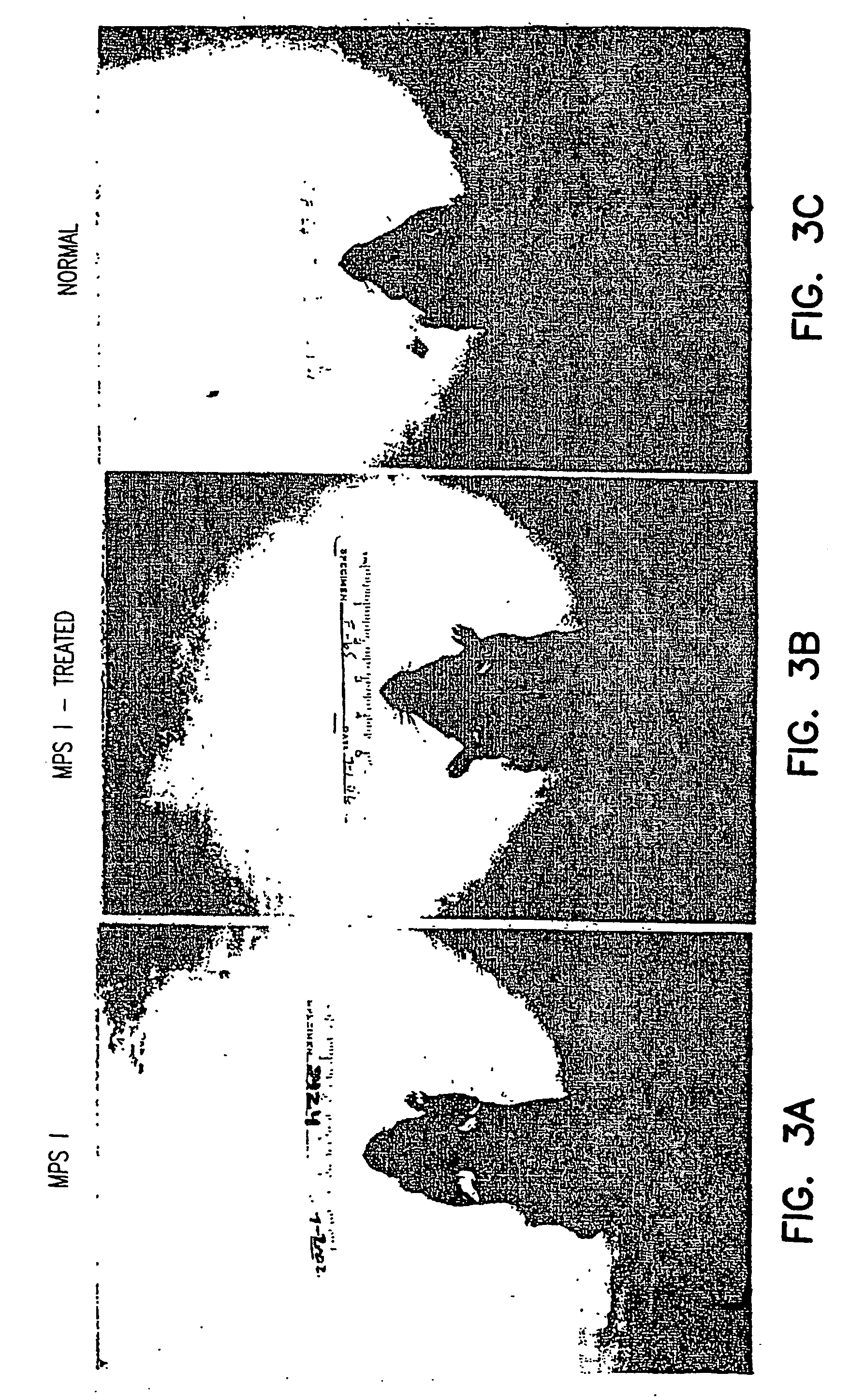 Methods of using vectors to treat metabolic disorders